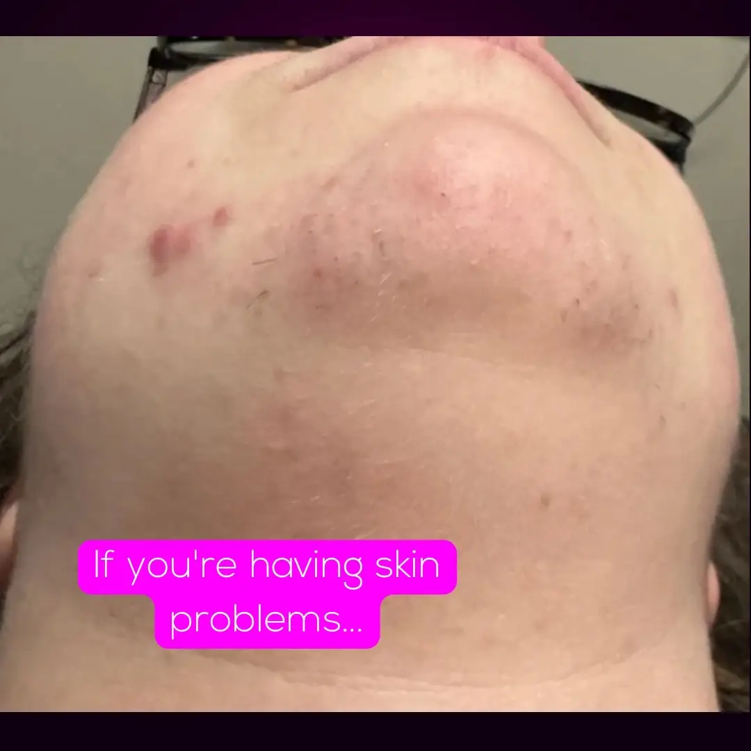 @Neurospice Beauty Electrolysis