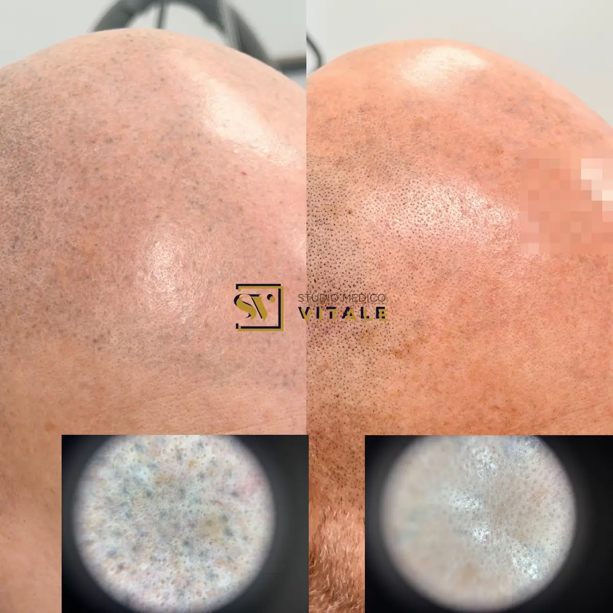 @Dr. Massimo Vitale