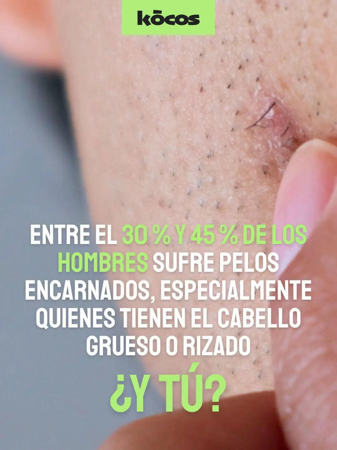 @Kocos_es