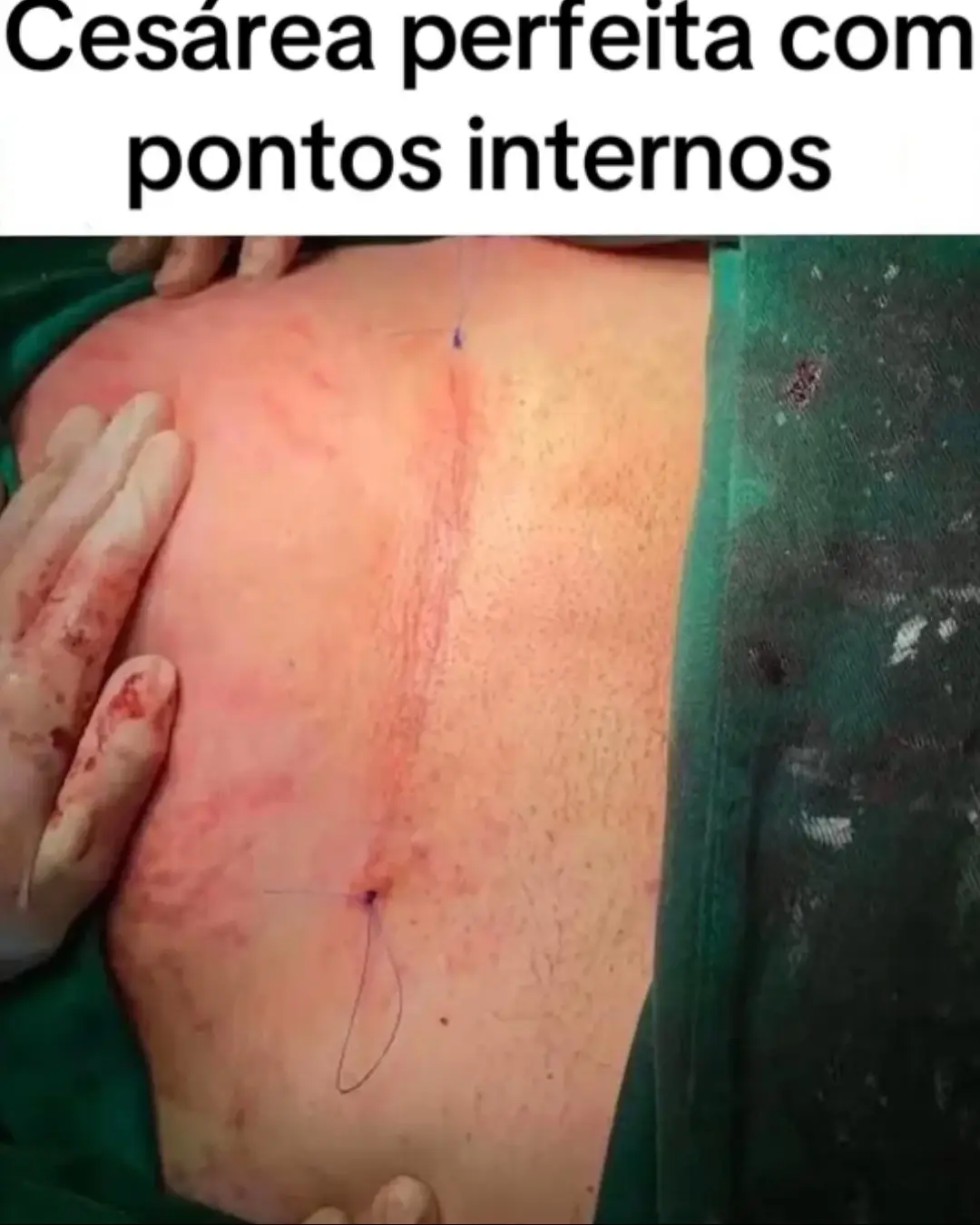 @De Mãe para Mãe