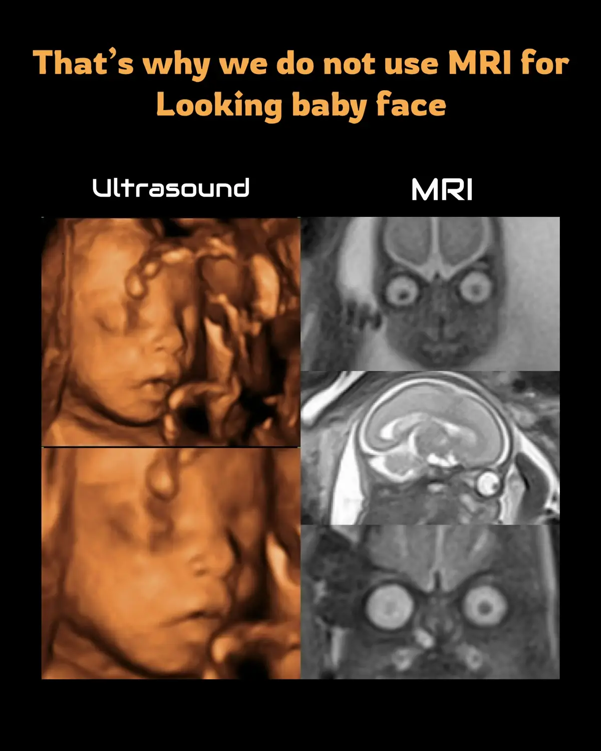 @Sobat Radiology