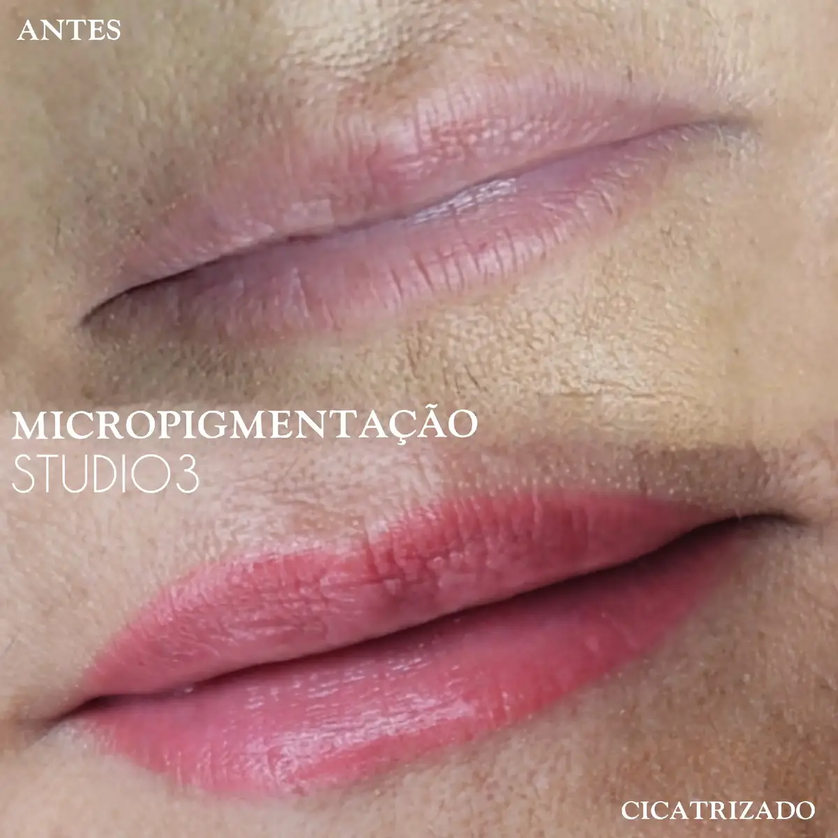 @Vânia Costa | Transformação