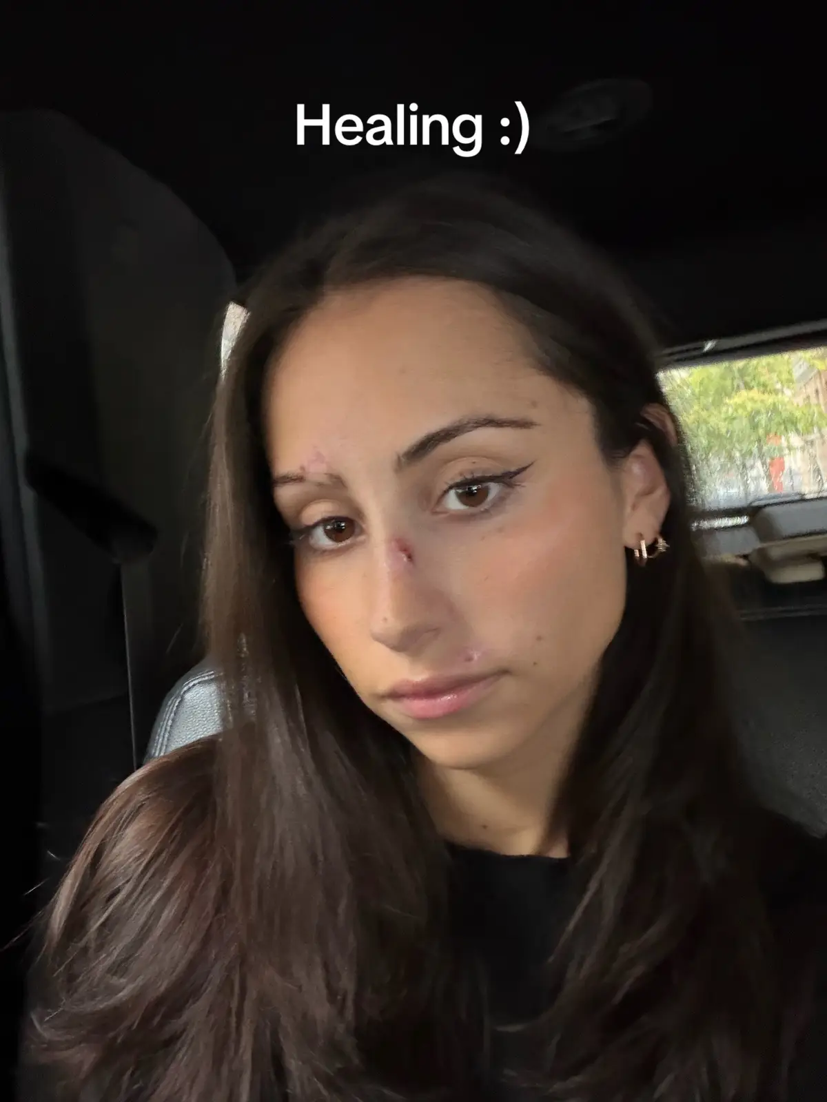 @alex lauren