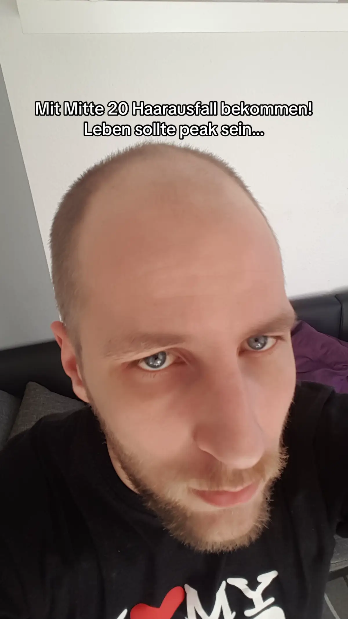 @Mr. Hairtransplant
