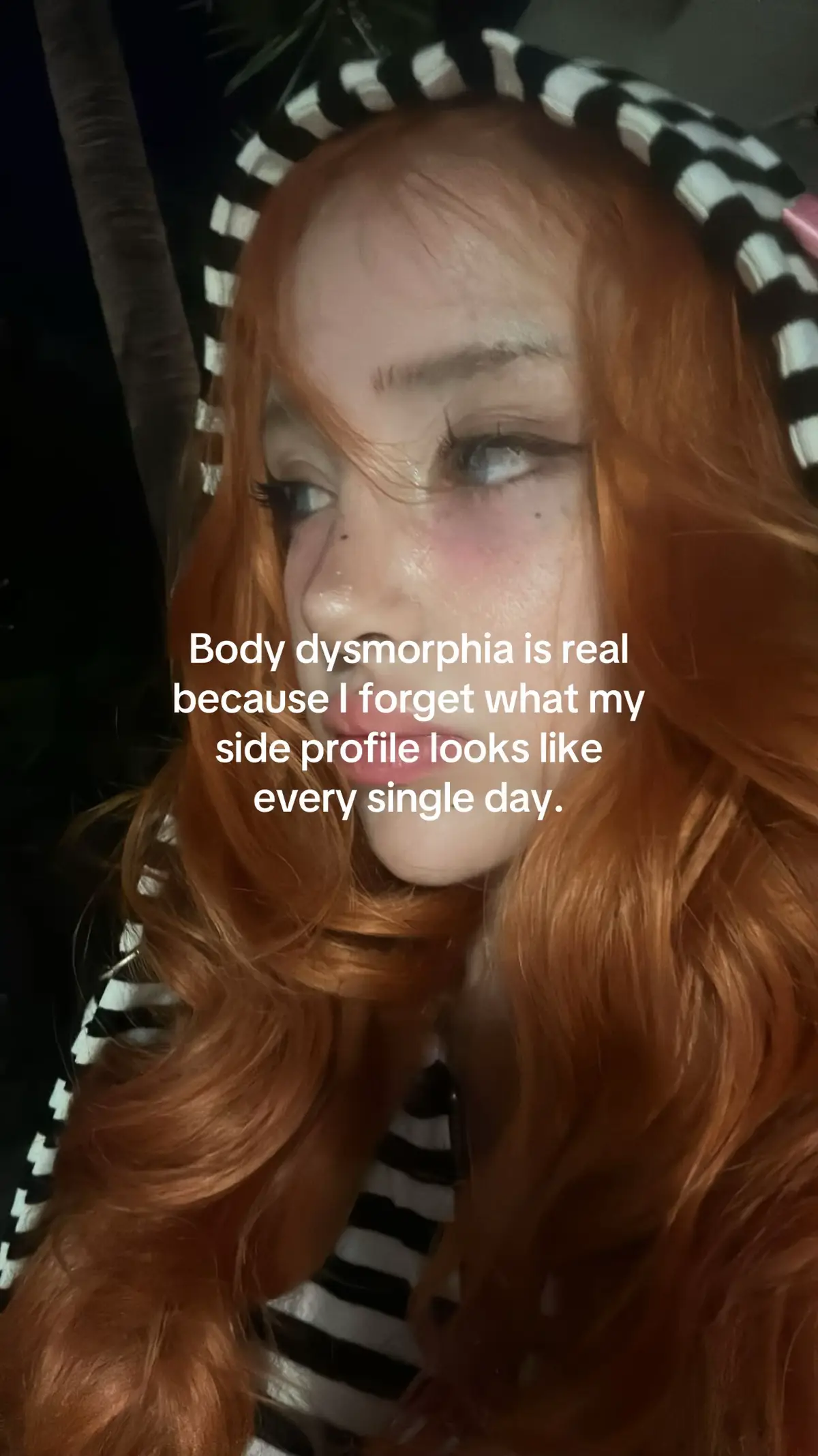 @Anoi
