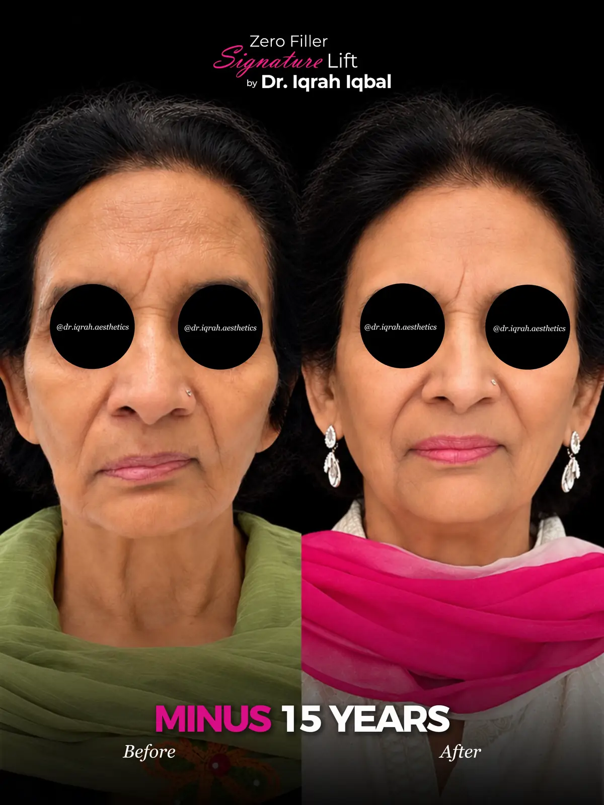 @Dr.Iqrah.Aesthetics