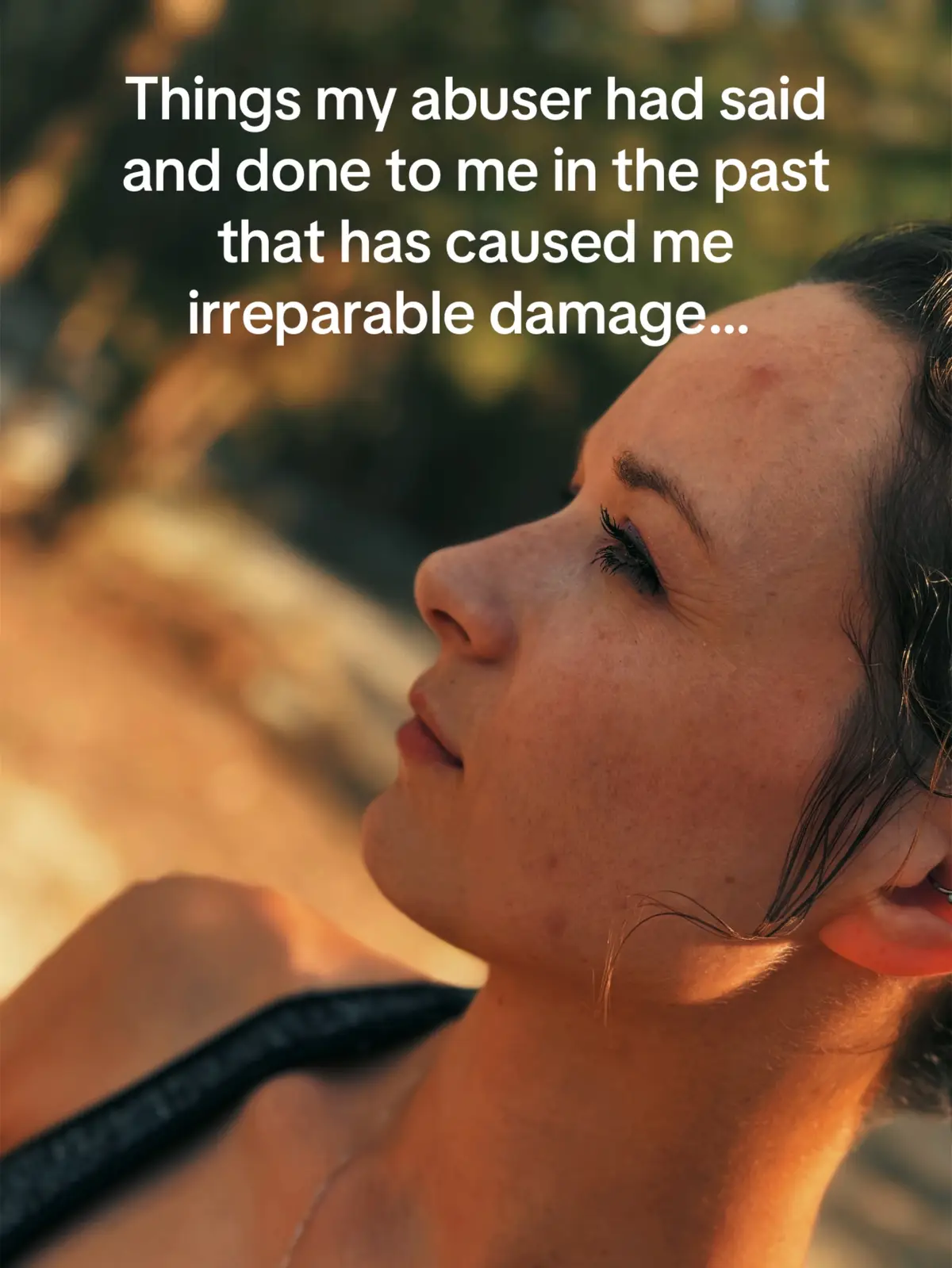 @SurvivingDv