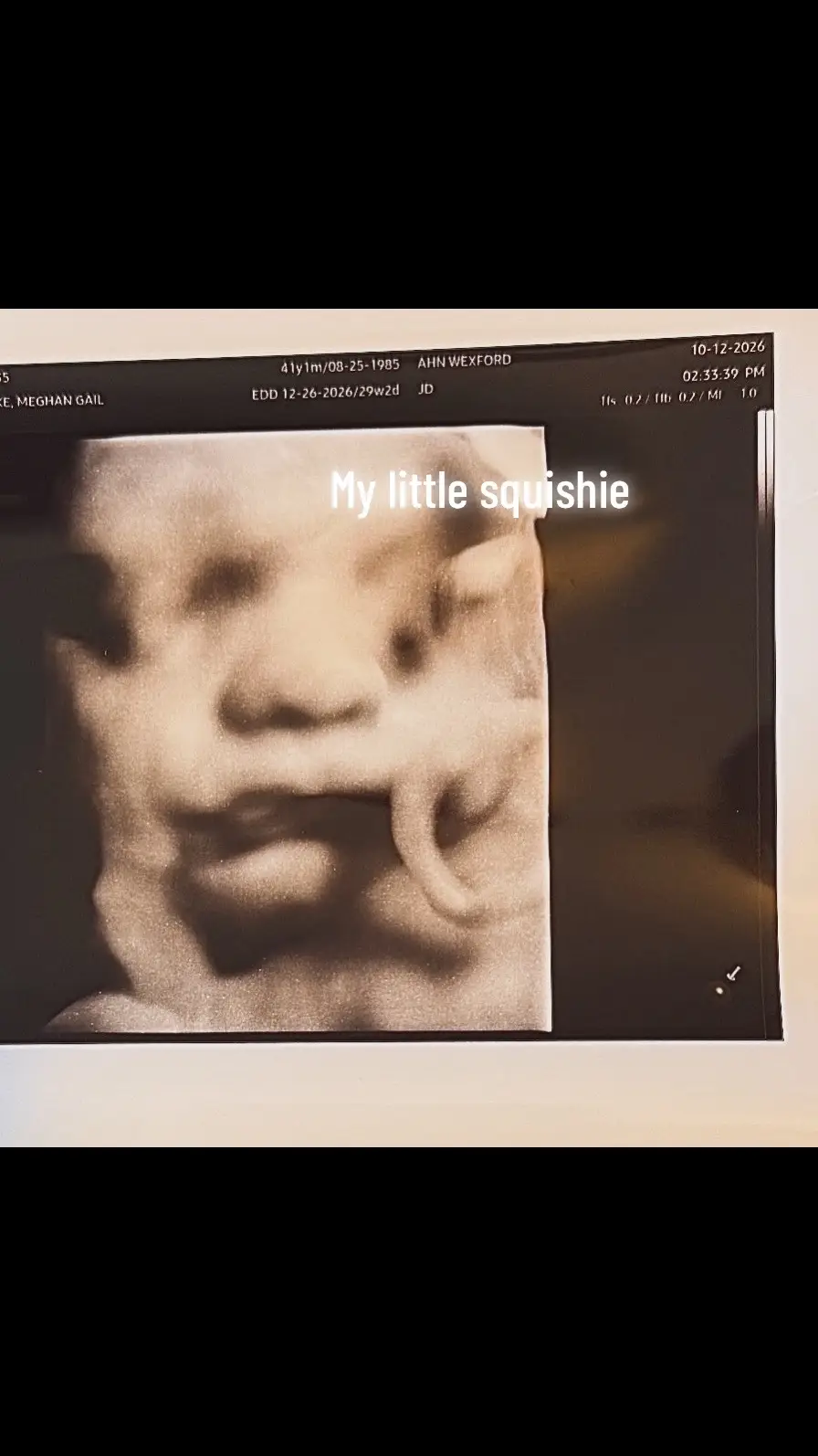 @M 🤍