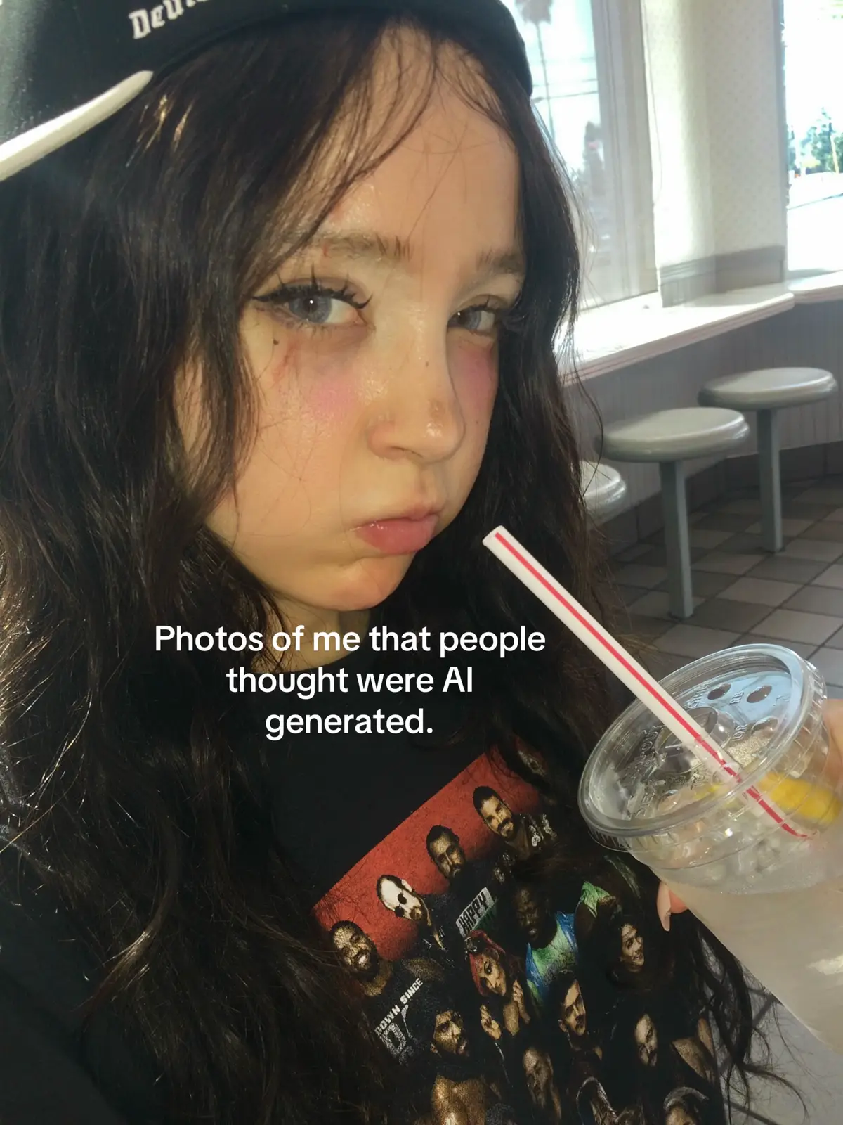 @Anoi