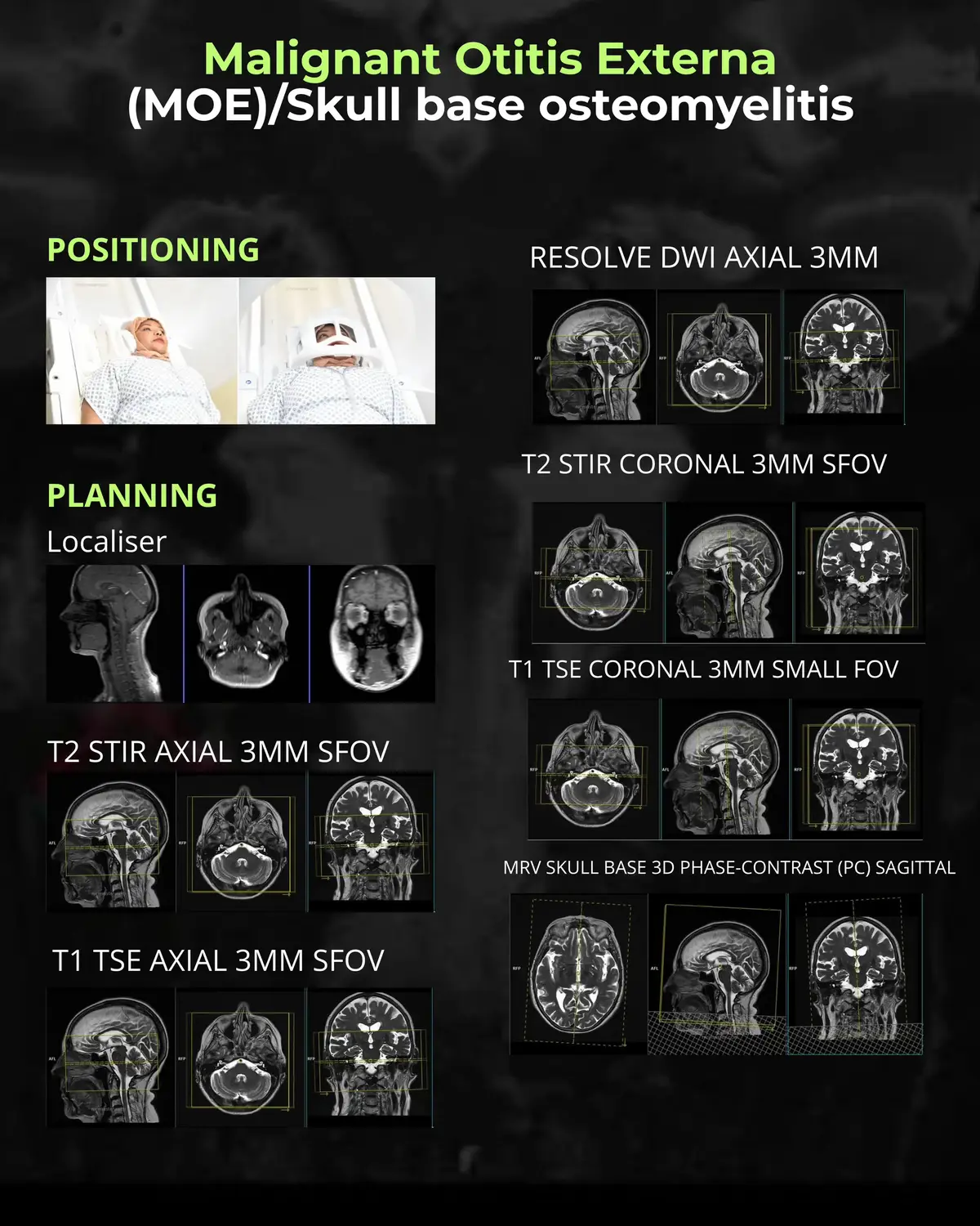 @Sobat Radiology