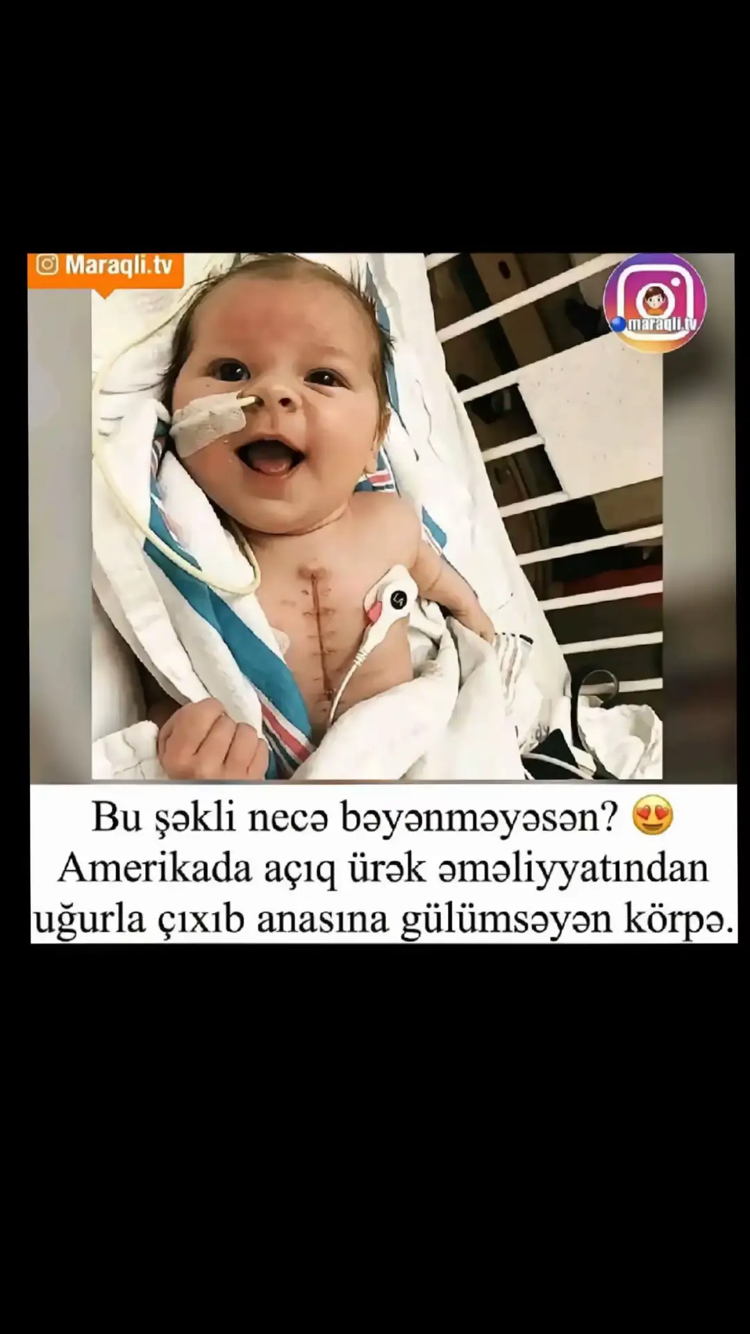 @Kamran Qəbələli 36