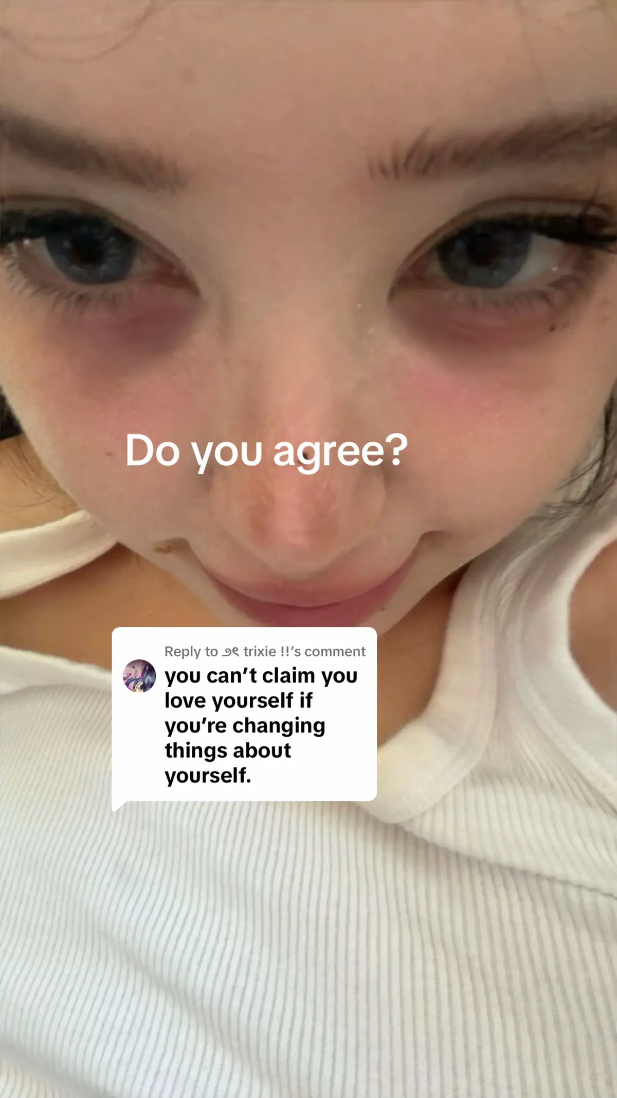 @Anoi