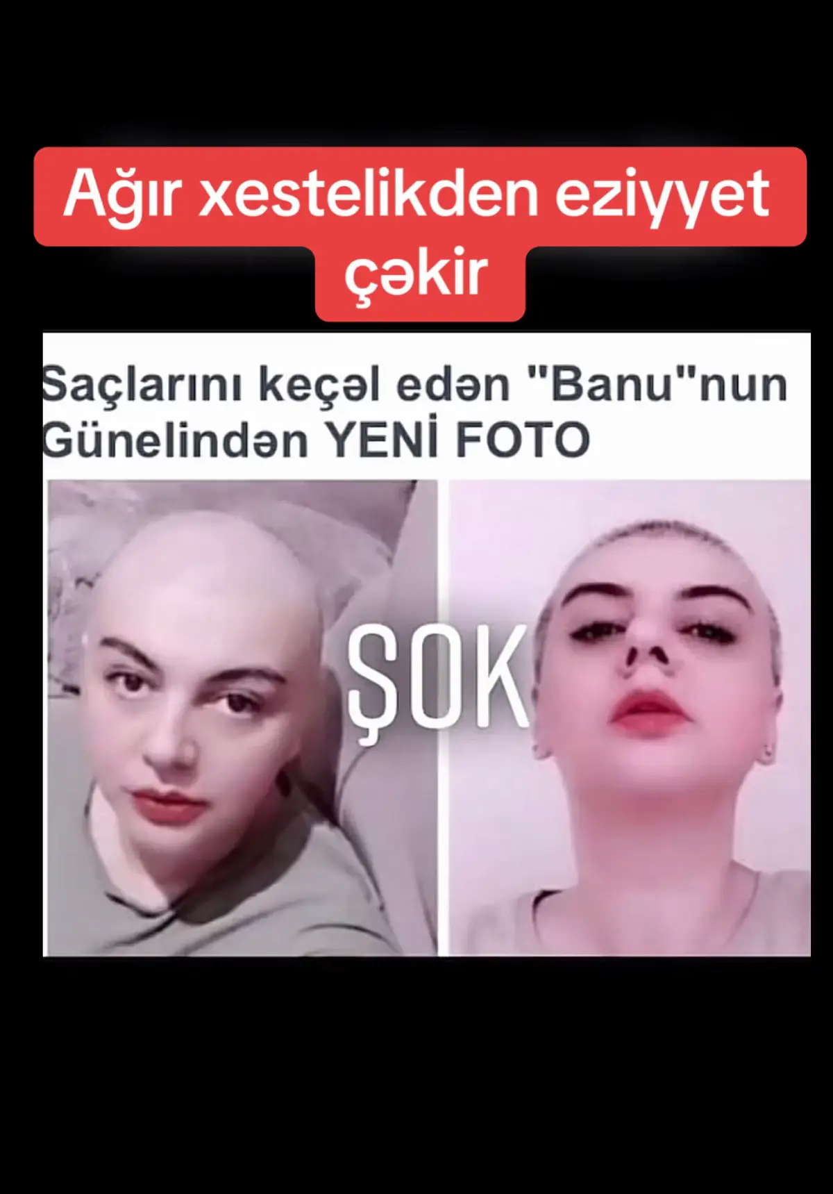 @the_baku