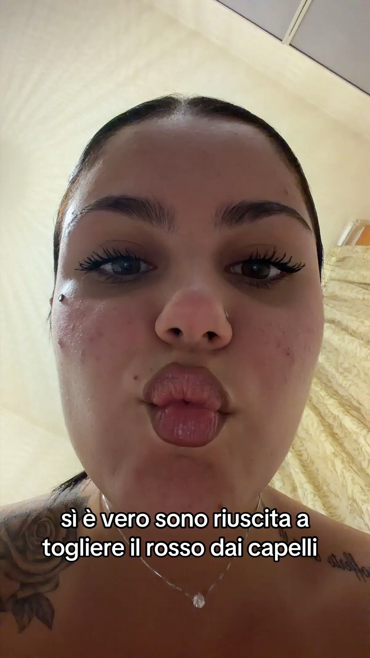 @ale