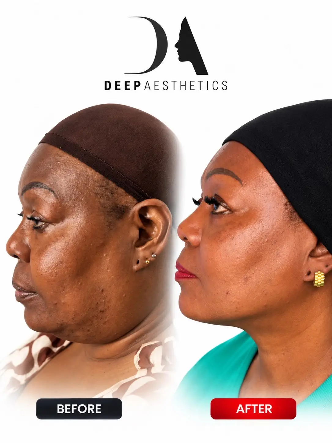 @deepaesthetics_official
