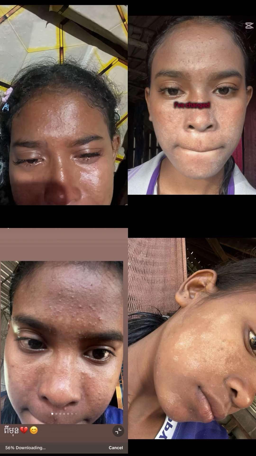 @សេត ស្រីនីត