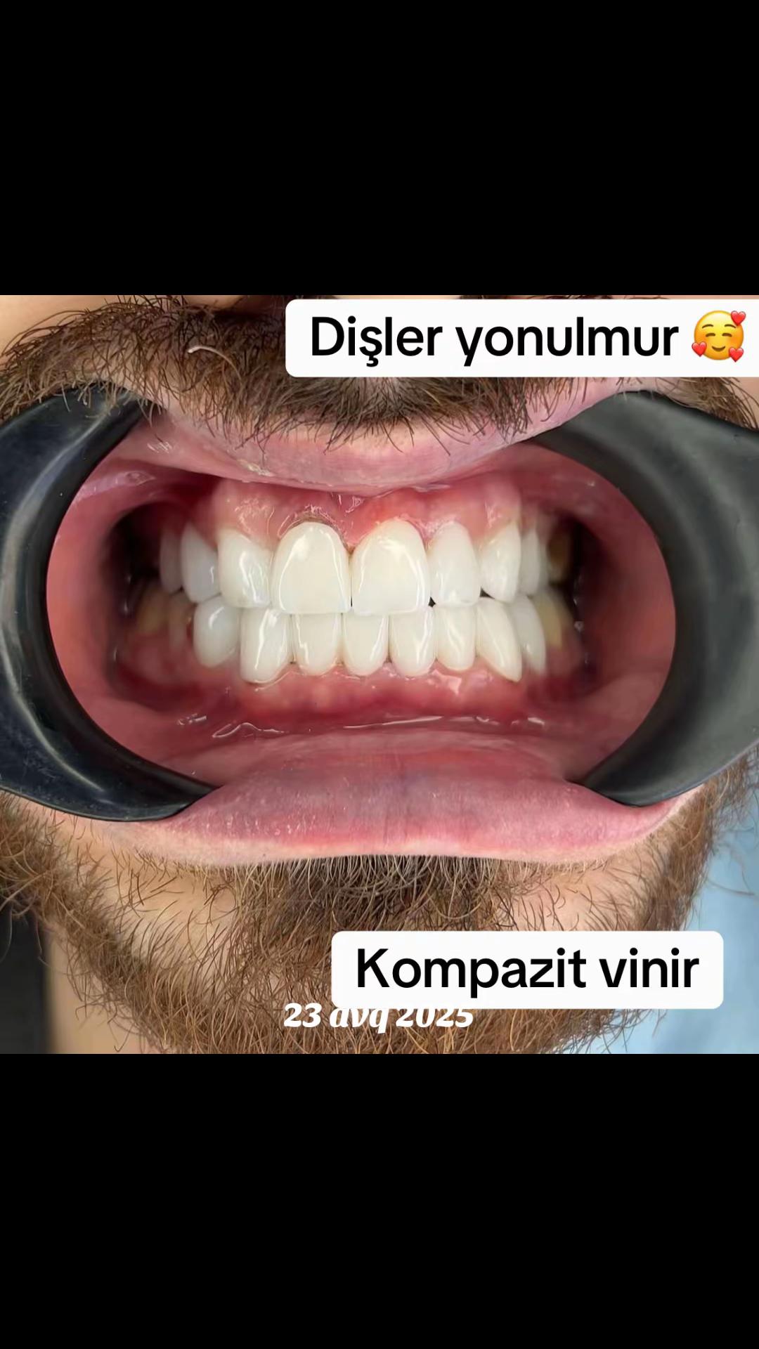 @Dentist_Günel