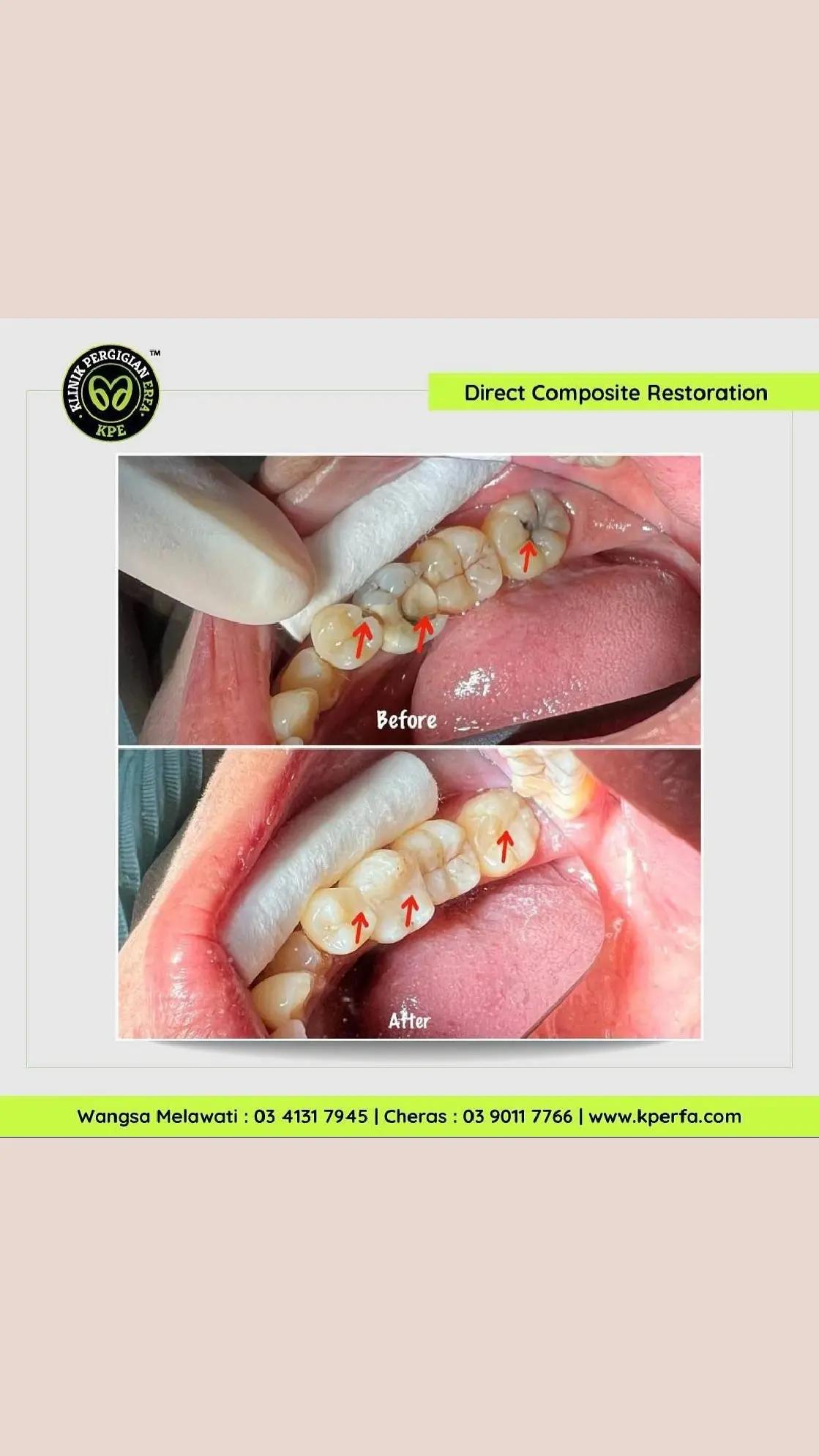 @Klinik Pergigian Erfa