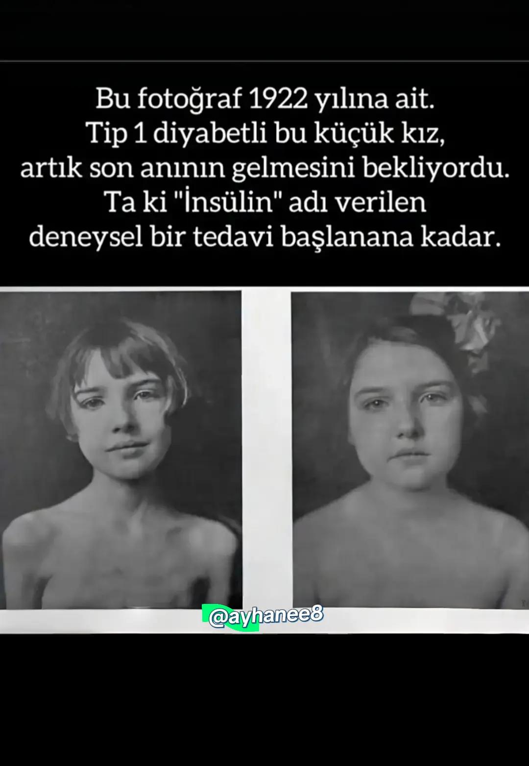 @berat25