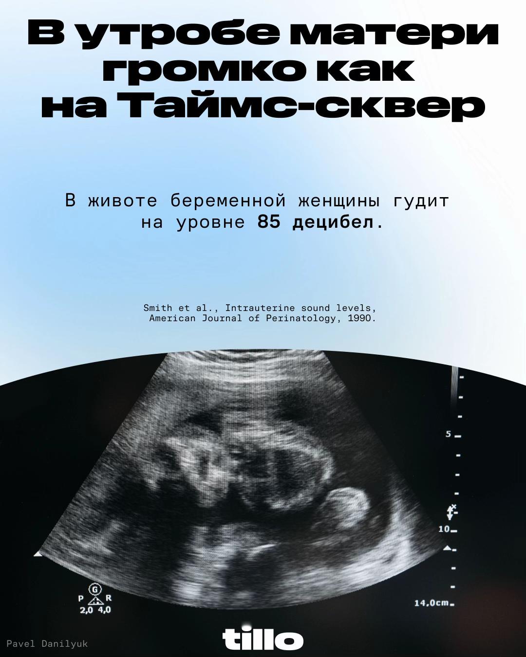 @Тилло Медиа