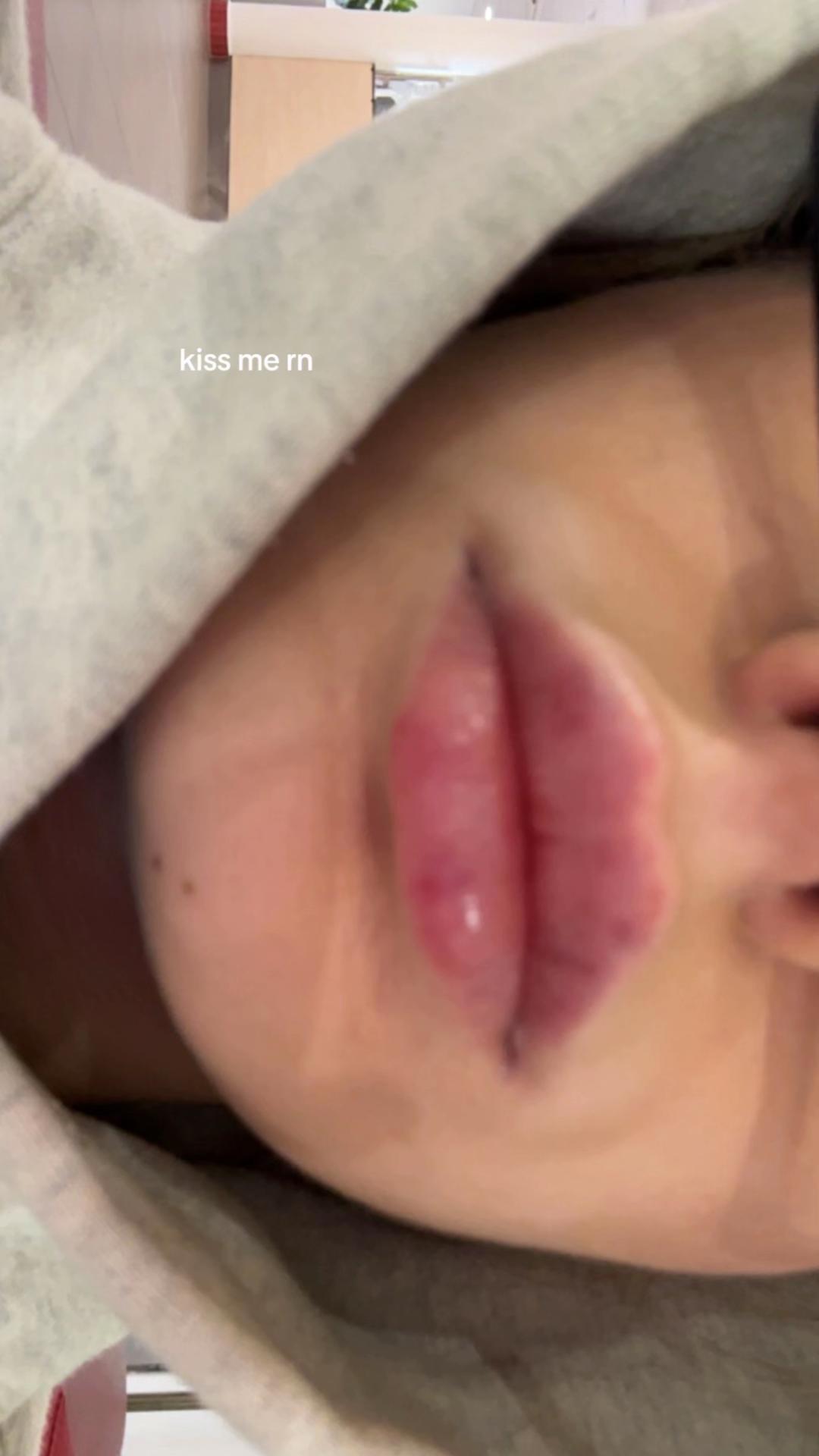 @kylie