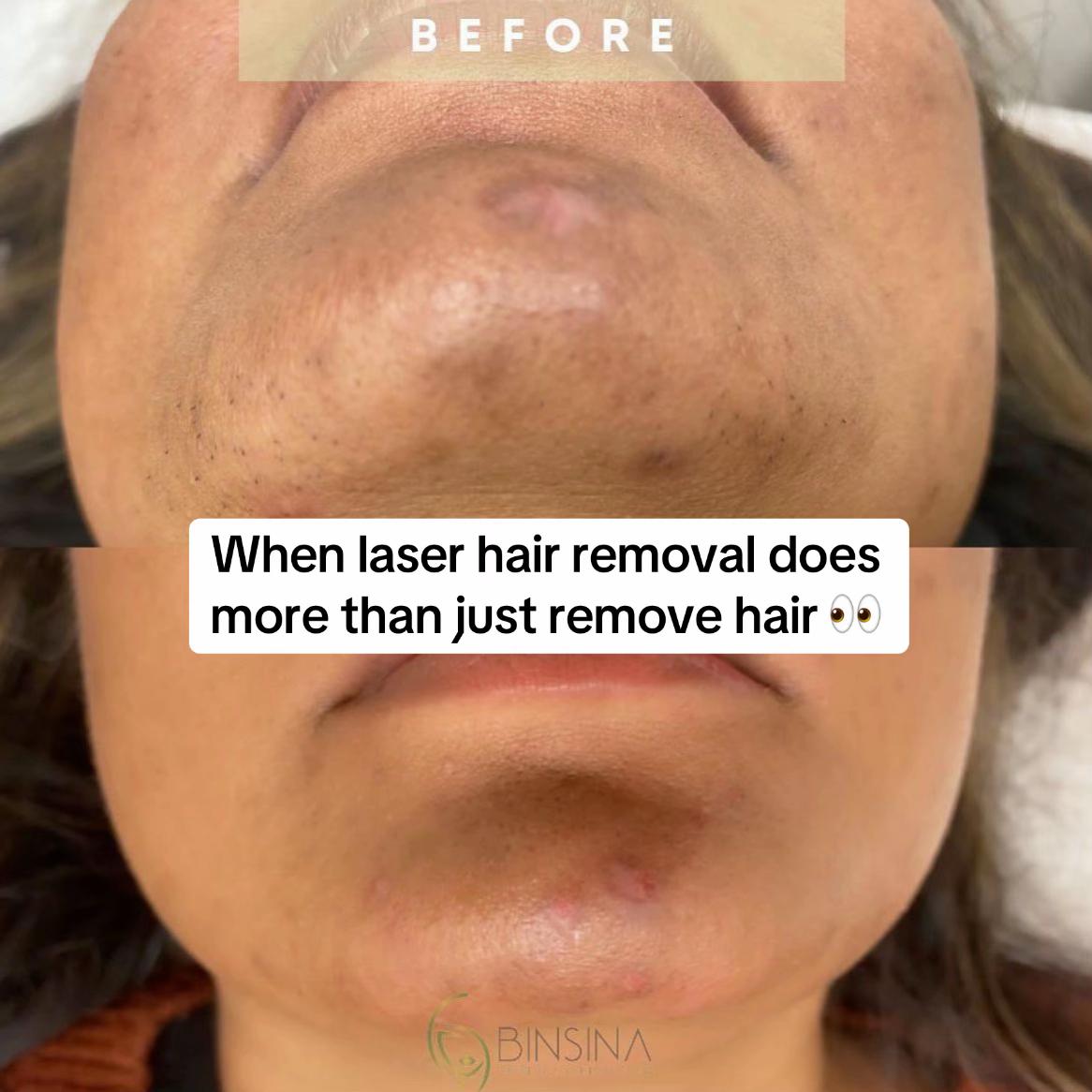 @Binsina Laser & Skin Clinic