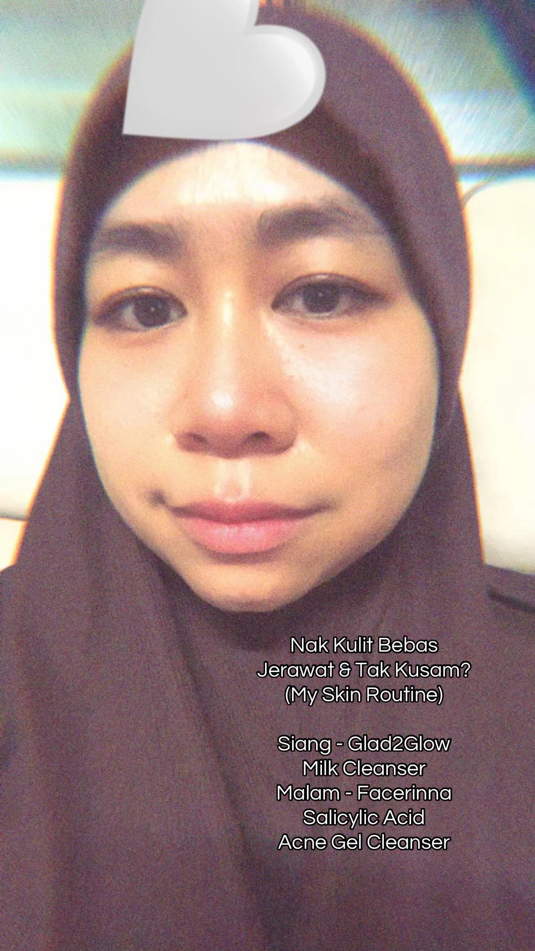@Aida Beauty16