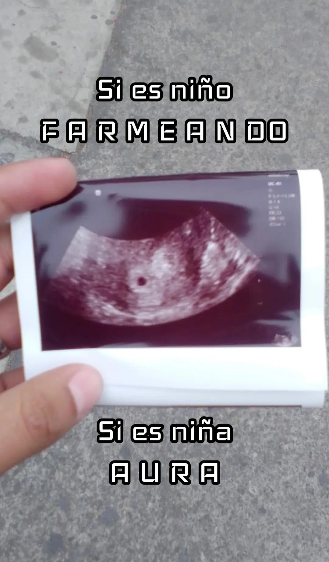 @Sam Lua