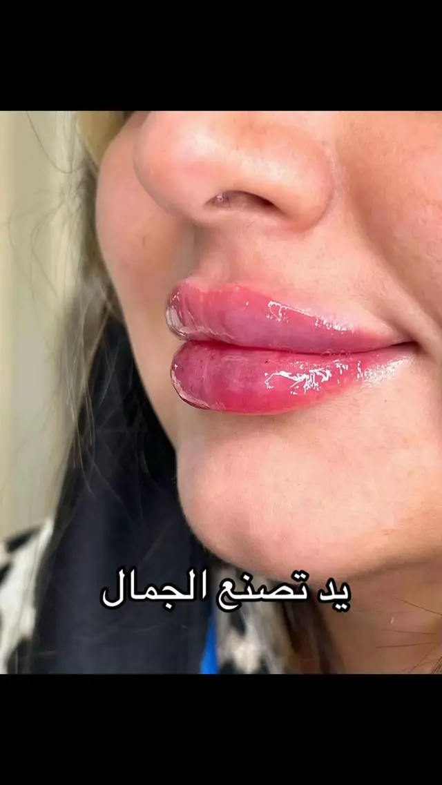 @Dralaa waheedدآلاءوحيد🇸🇦🇪🇬