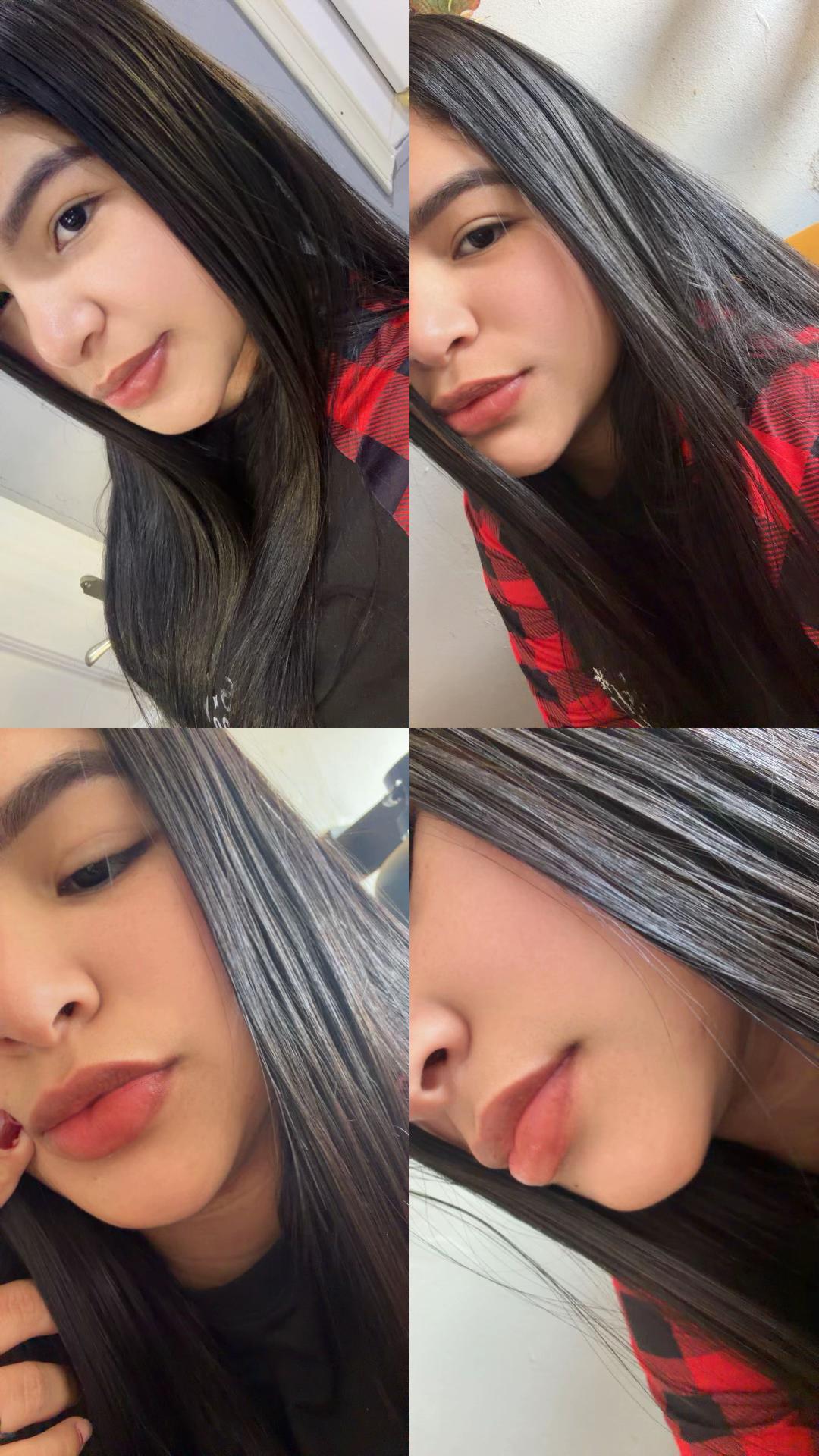 @Yaidilin Leidenz
