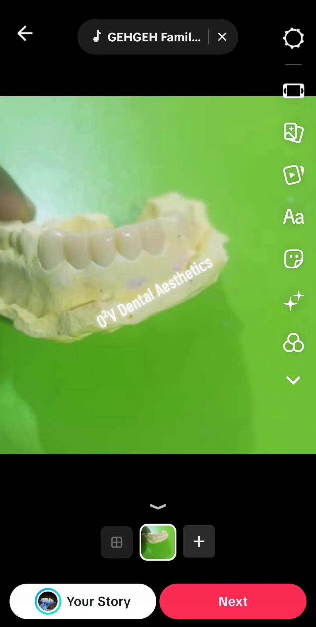 @O&sup2;V Dental Aesthetics Hub🦷