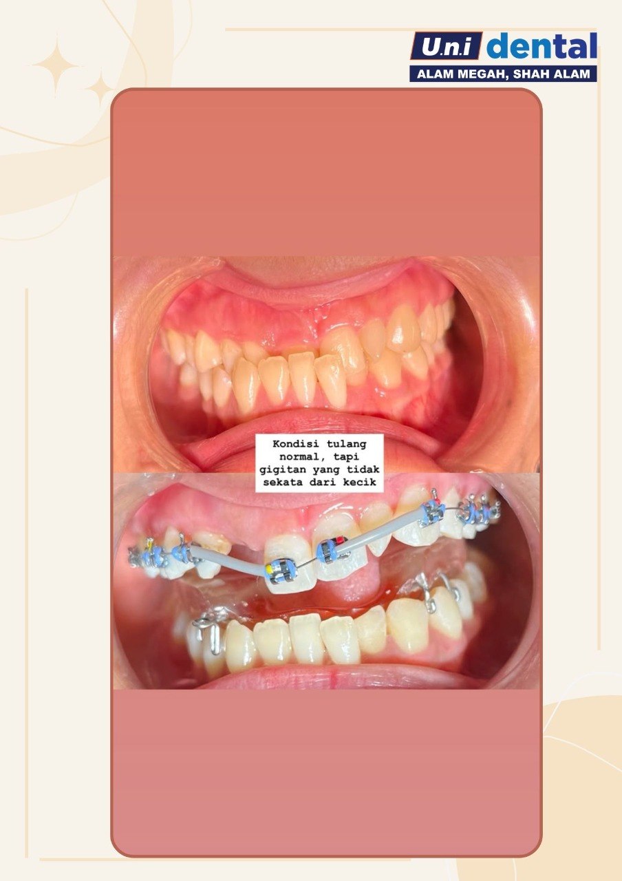 @Klinik UNI Dental Alam Megah