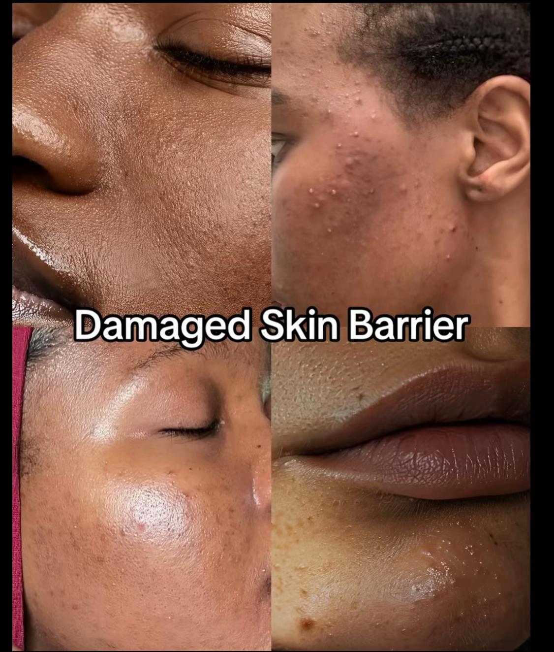 @Skincare vendor limbe