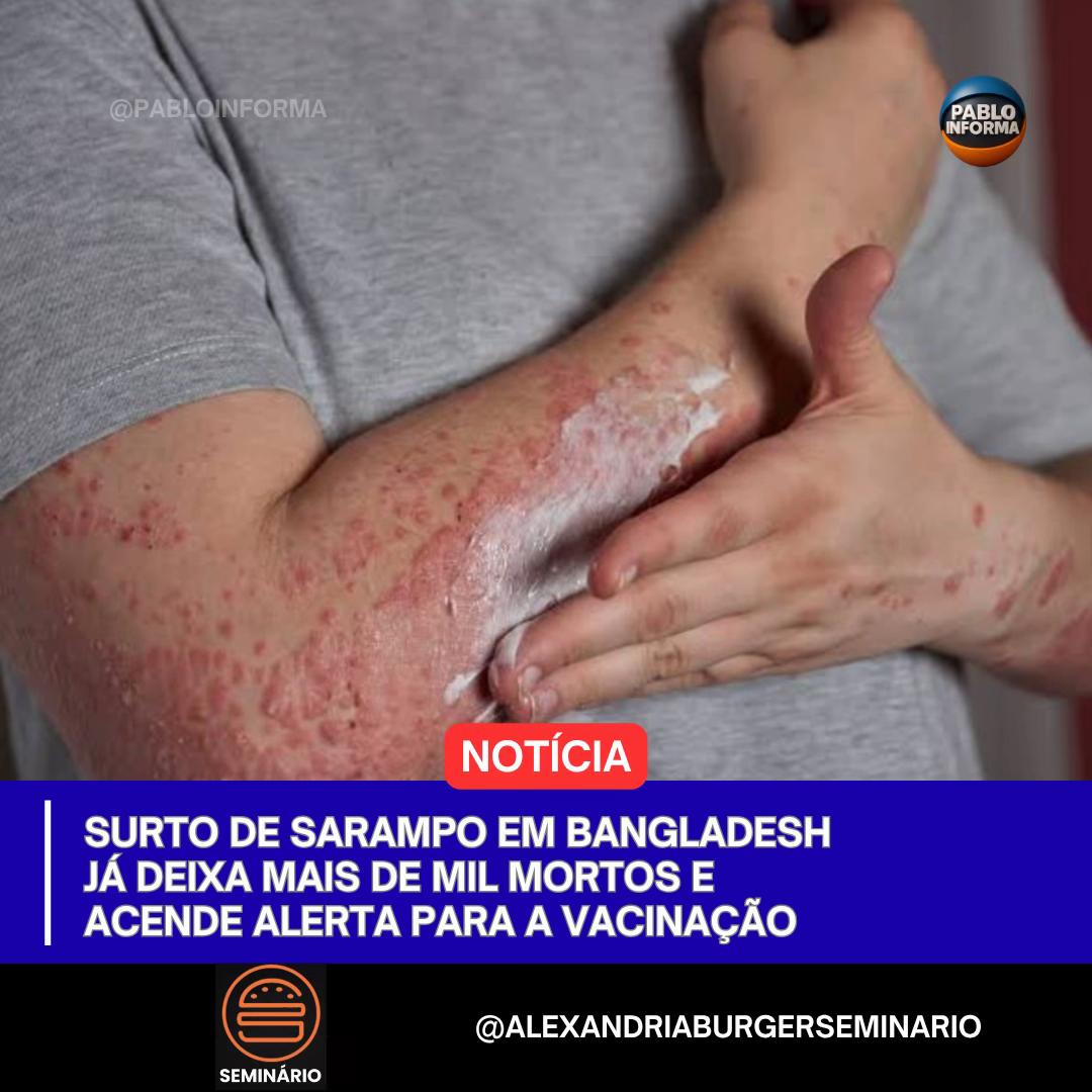 @Pablo Informa