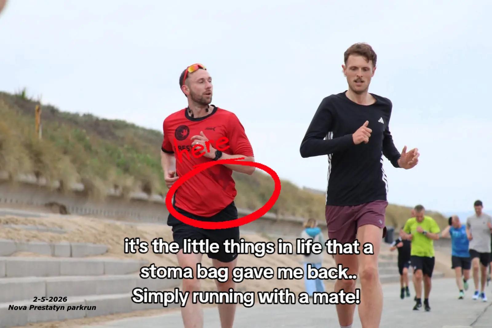 @Running Stoma