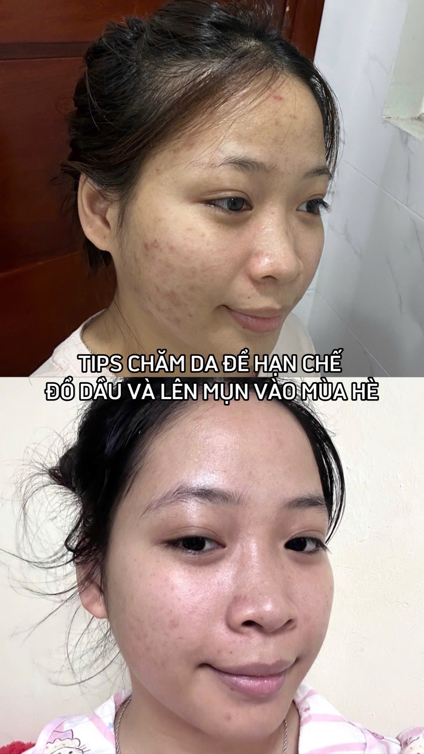 @Chi tiền làm đẹp