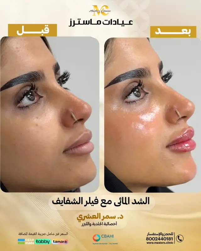 @عيادات ماسترز