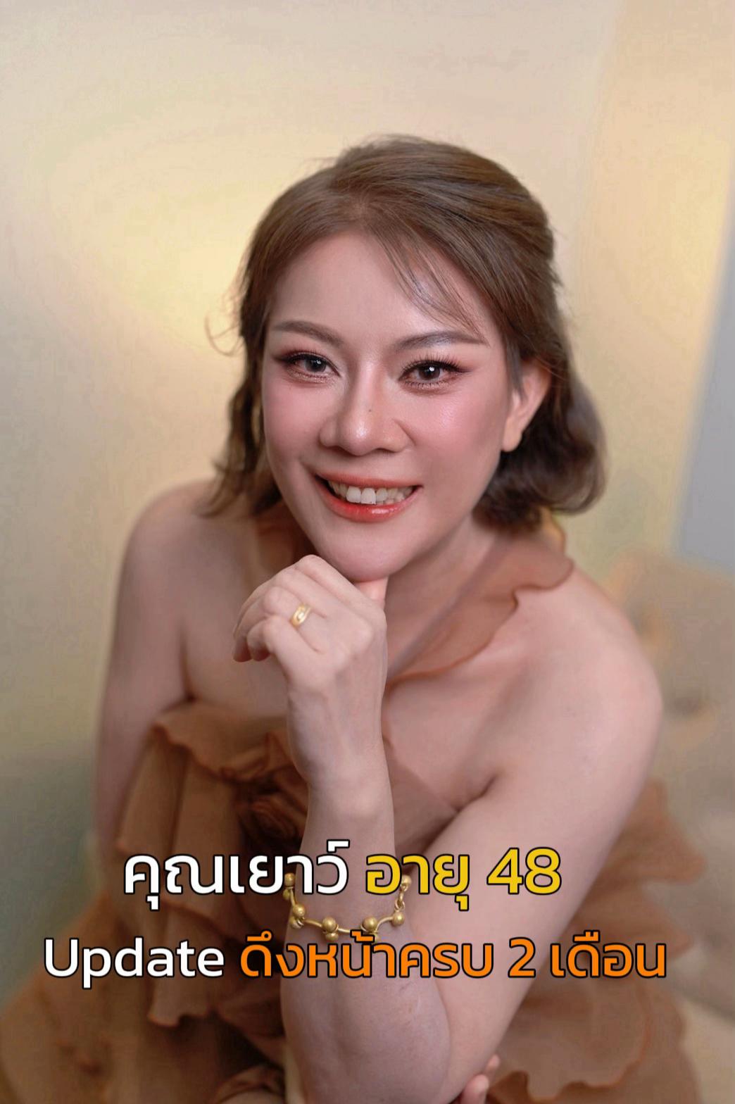 @ดึงหน้า ud clinic