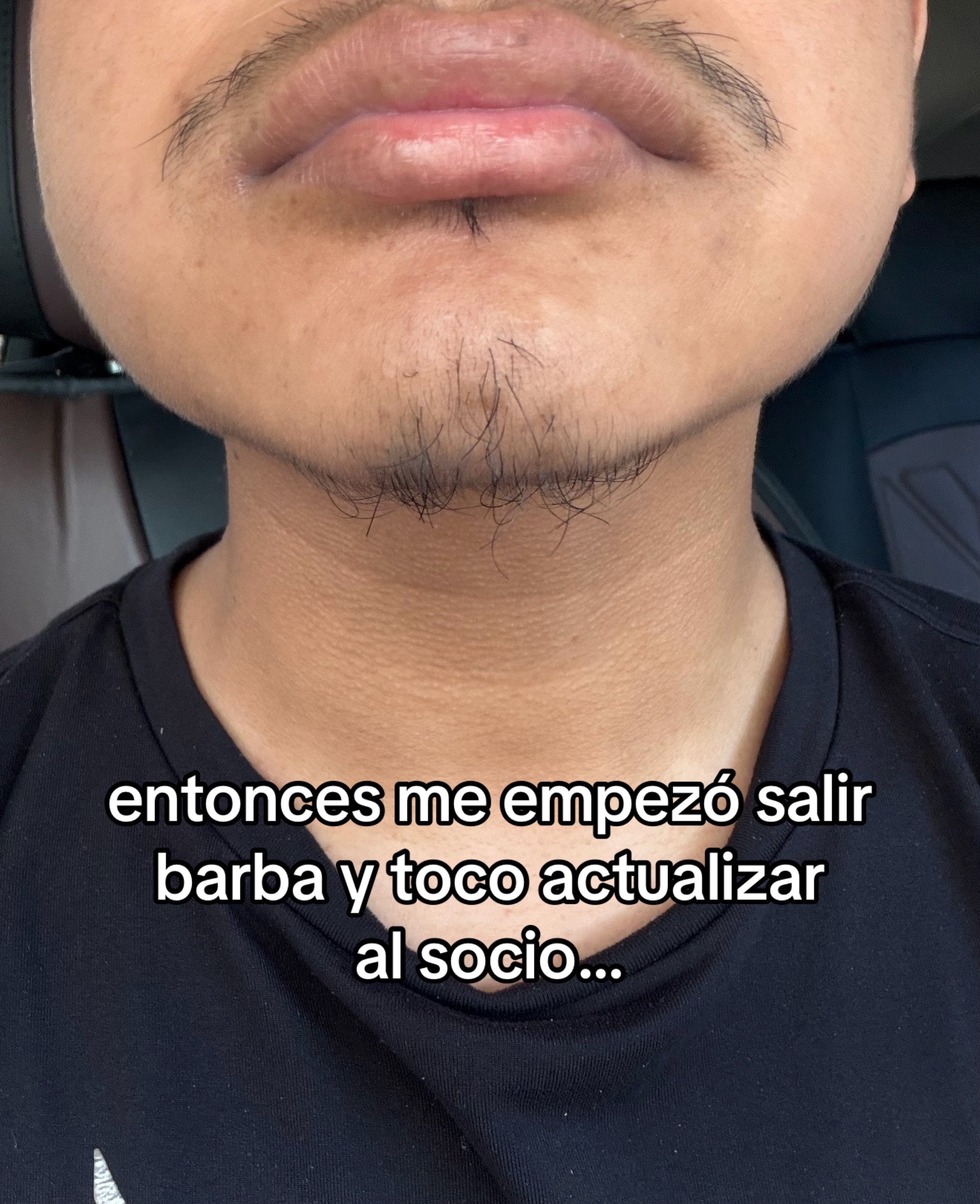 @️hermel.xj