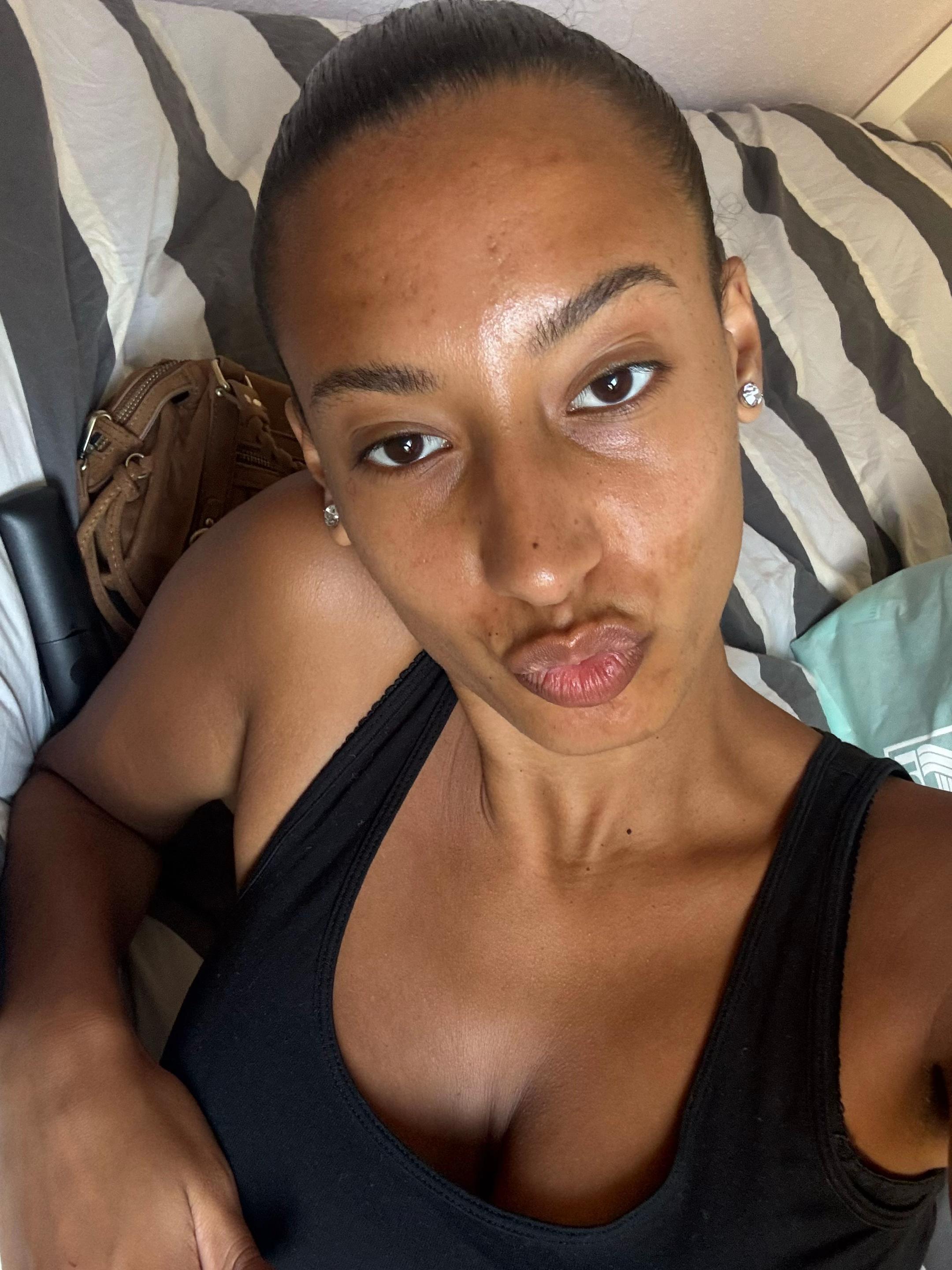 @🥰