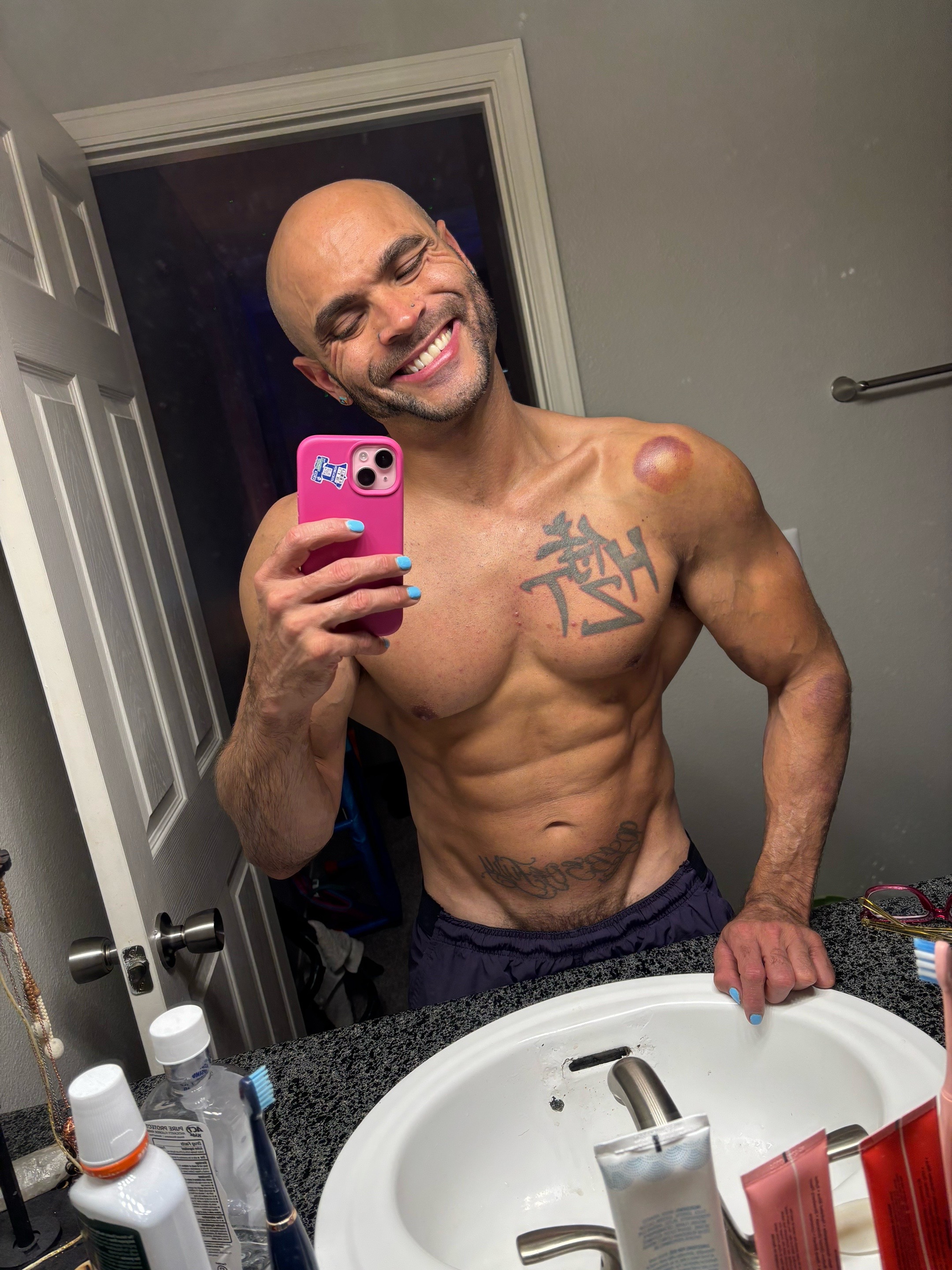 @Distorqueo