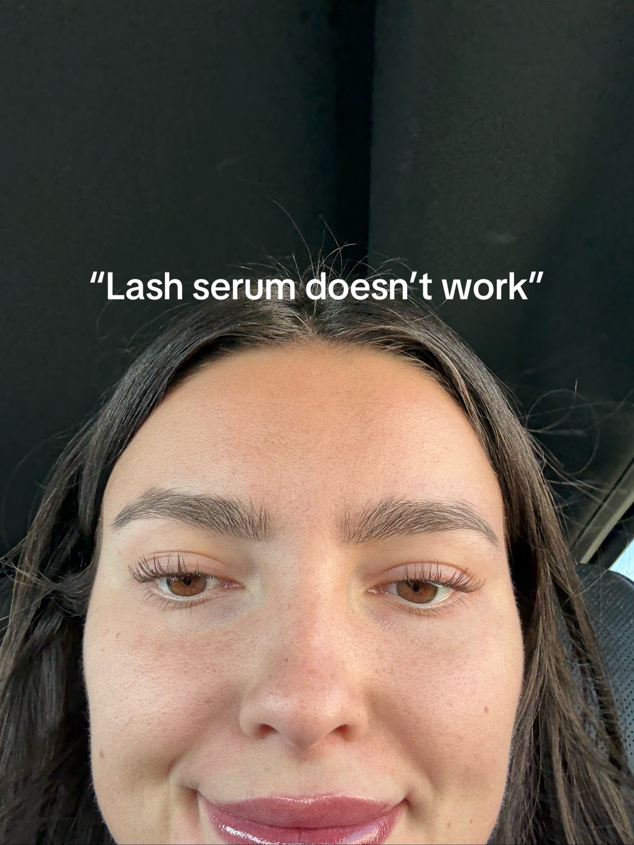 @tess