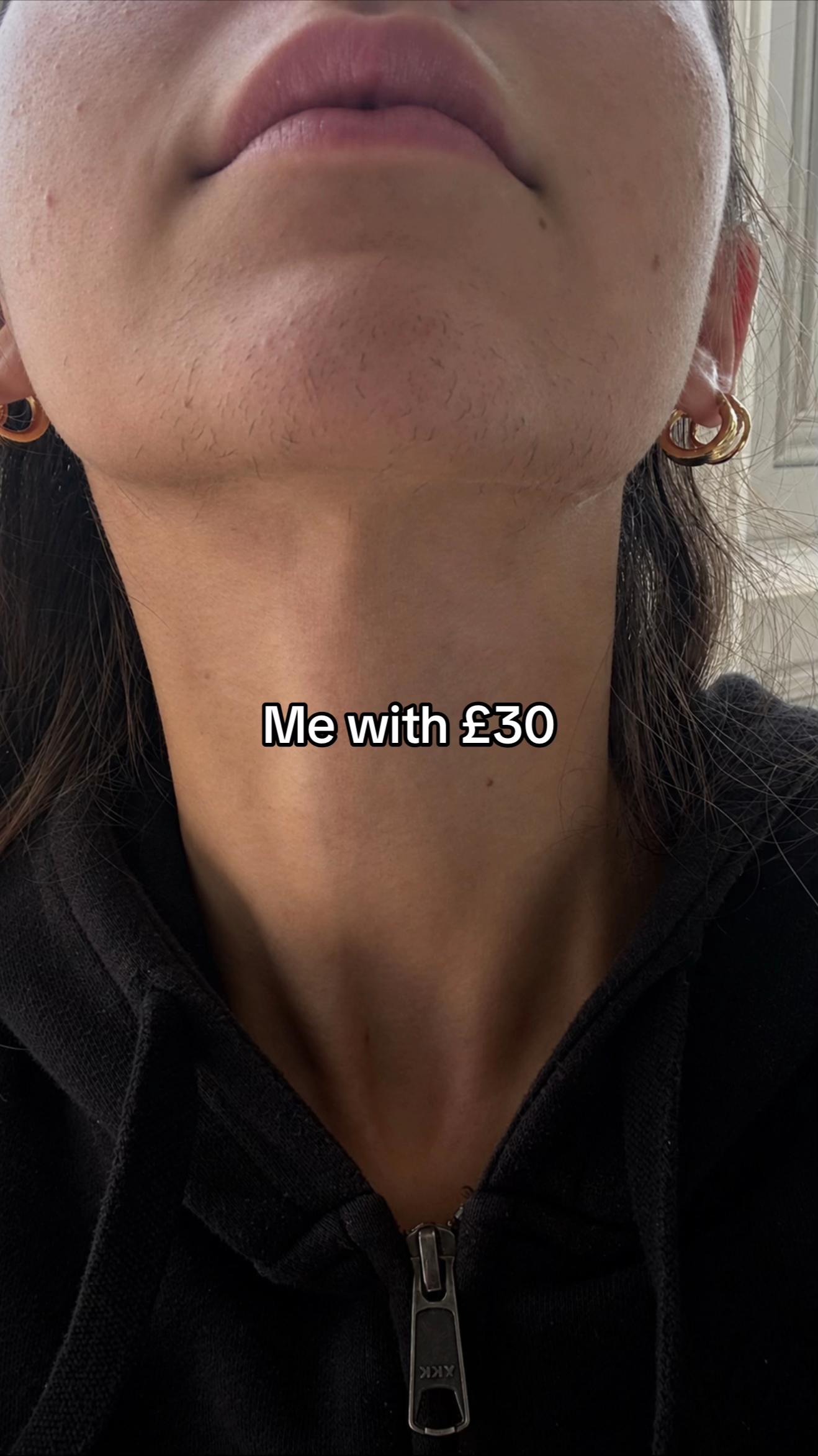 @London Laser and aesthetics