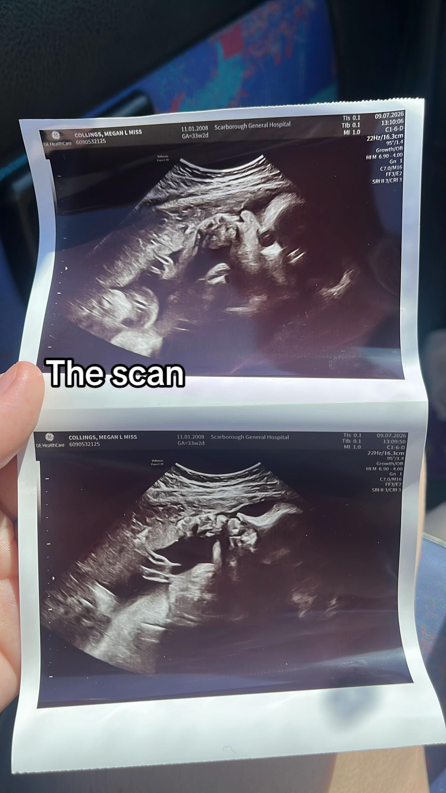 @meg.teenmum
