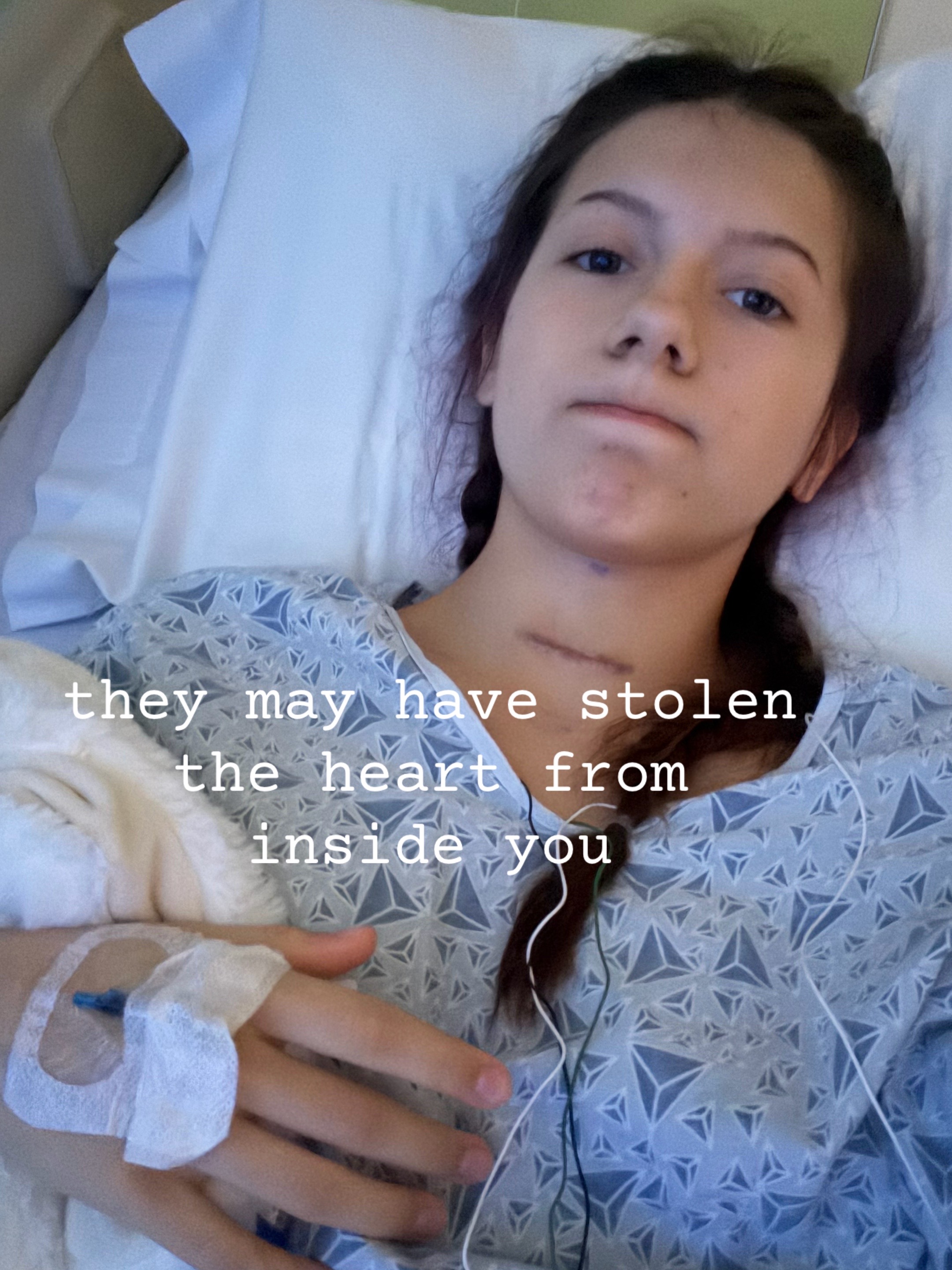 @️eviee