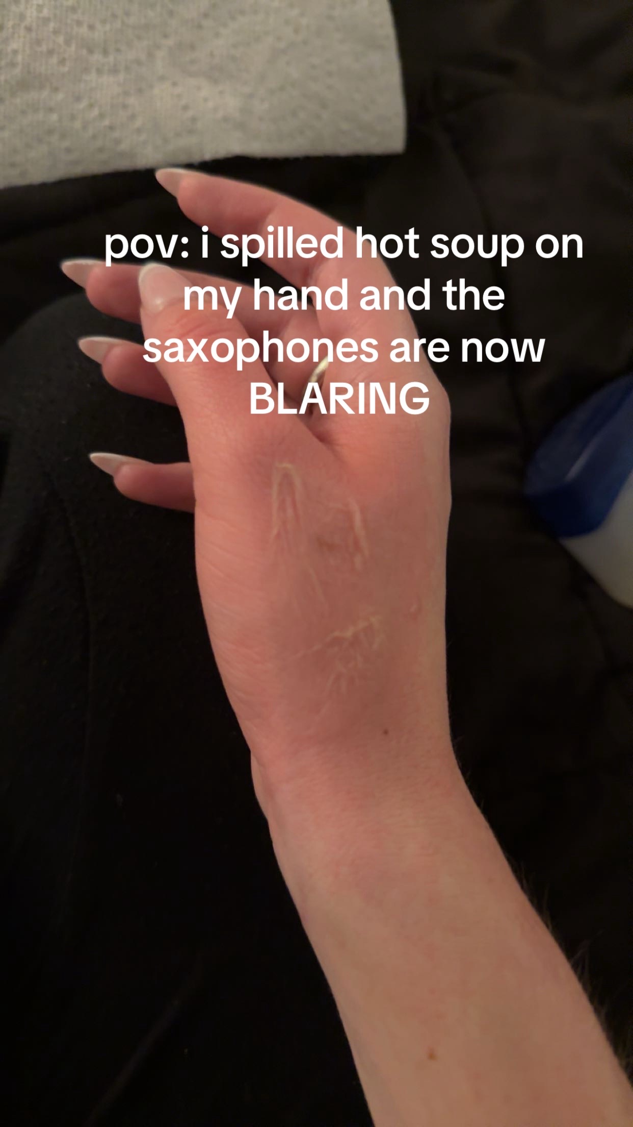 @mikenna