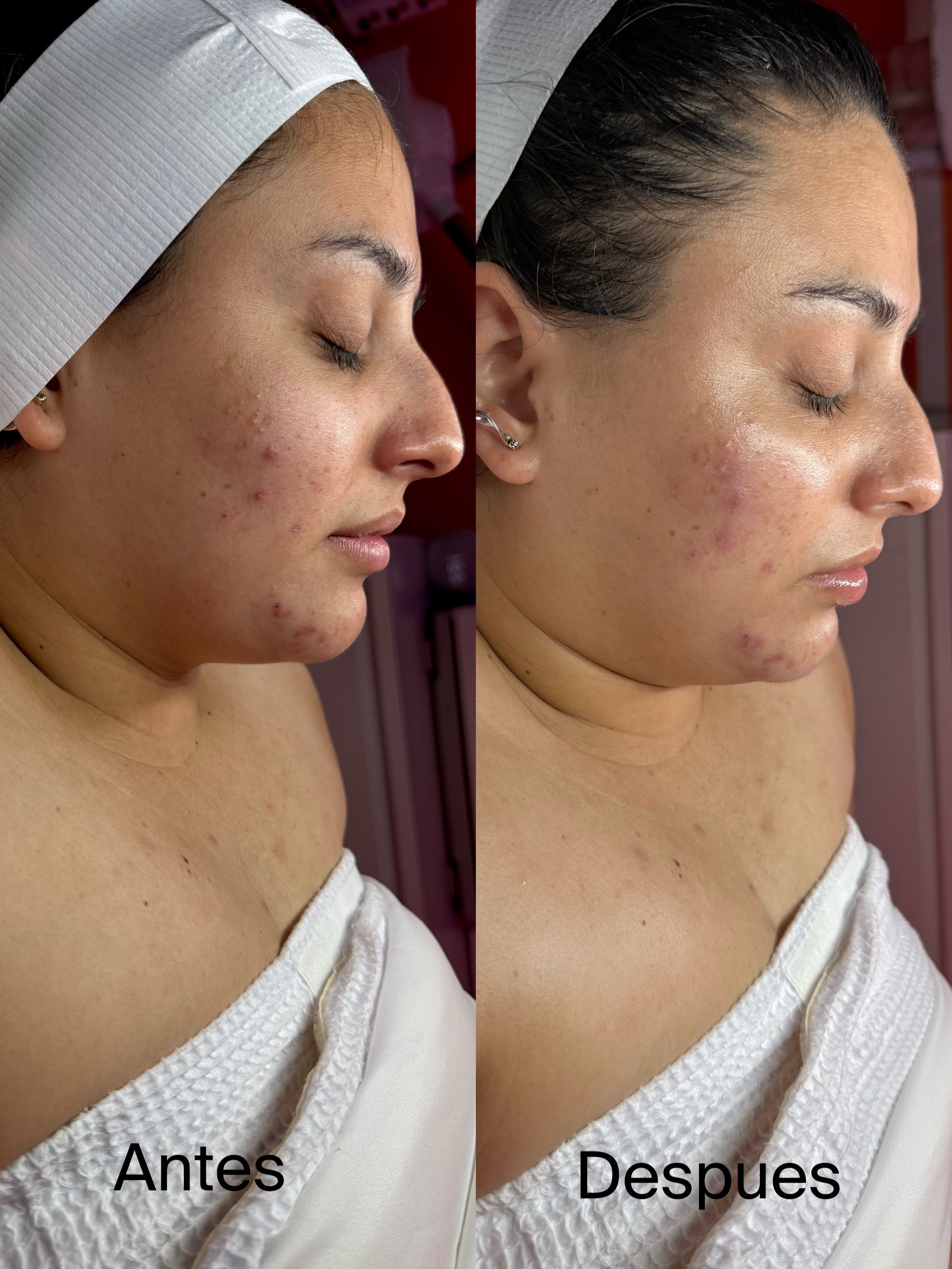 @HappySkinBySara