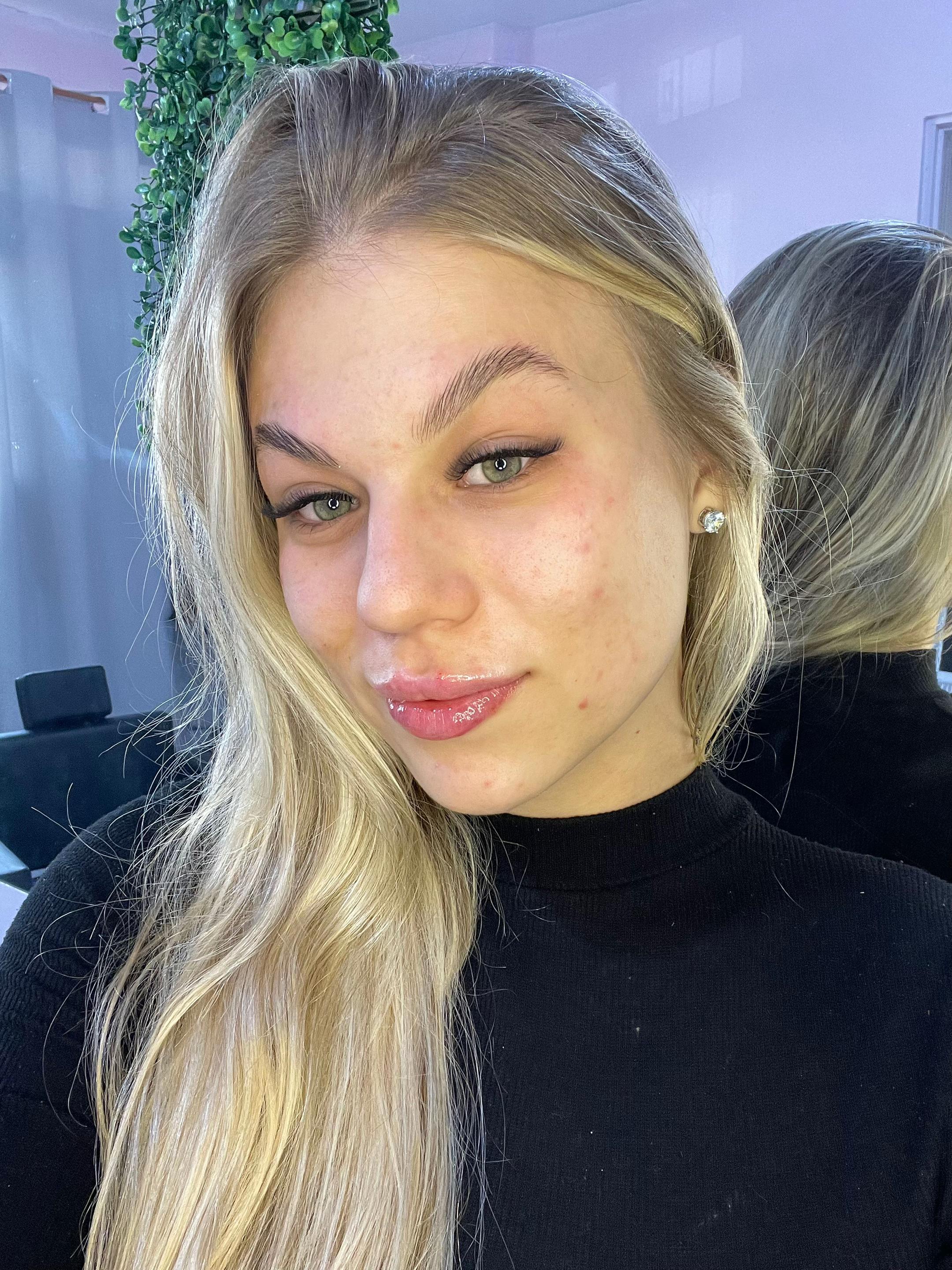 @rafaellawachholz
