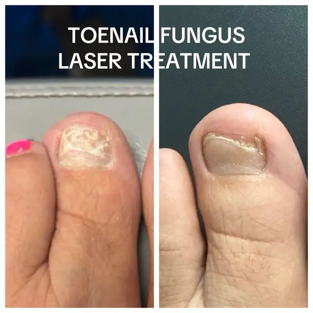 @Deniel Foot and Ankle Center