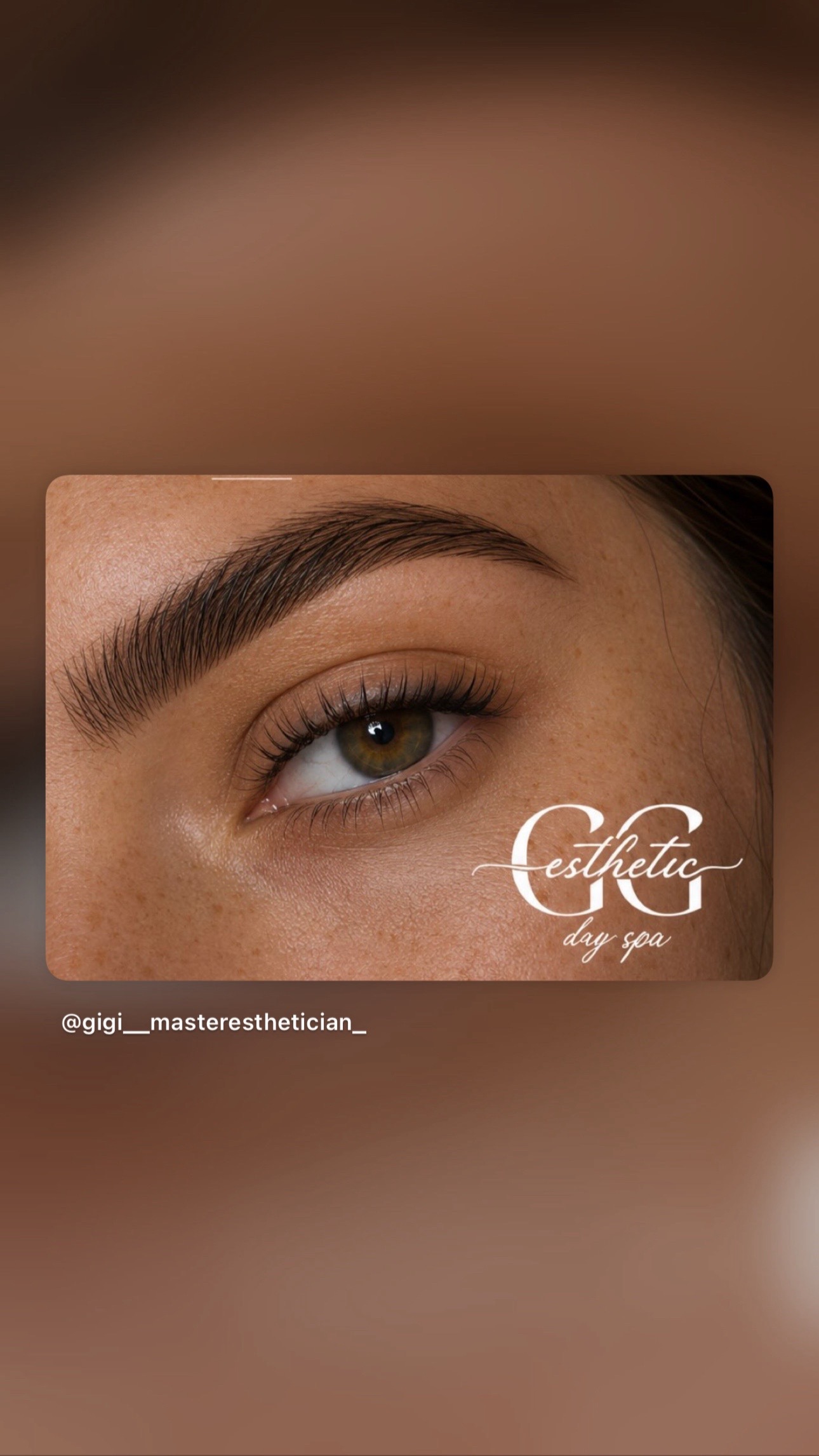 @♡ GG ESTHETICS ♡